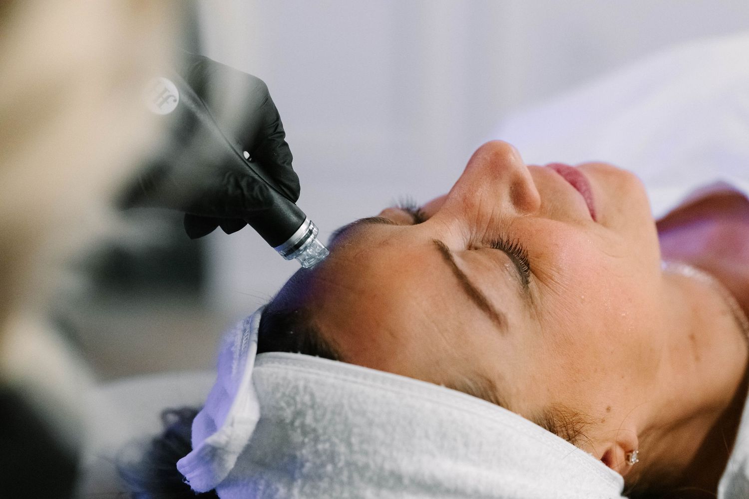 Esthetician applying microneedling treatment to woman's face in a professional skincare clinic setting.