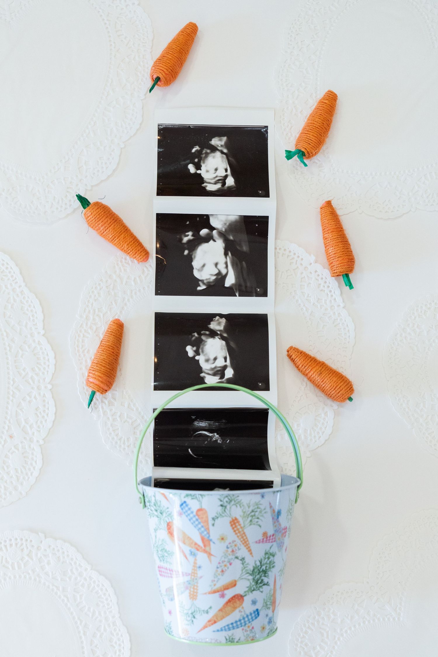 Ultrasound photos strip displayed with decorative orange carrots and an Easter bucket on white background.