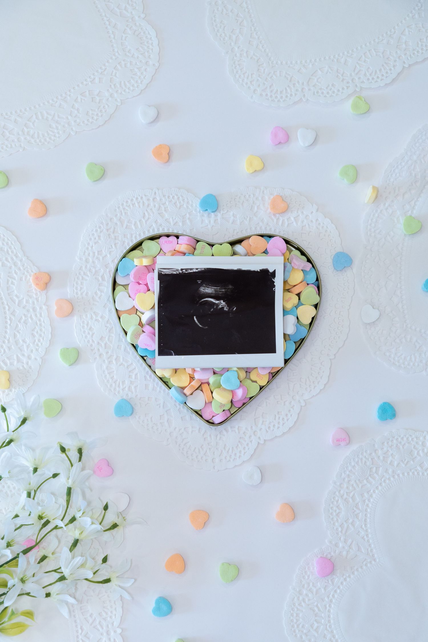 Ultrasound photo in heart-shaped candy box surrounded by colorful pastel conversation hearts on white background.