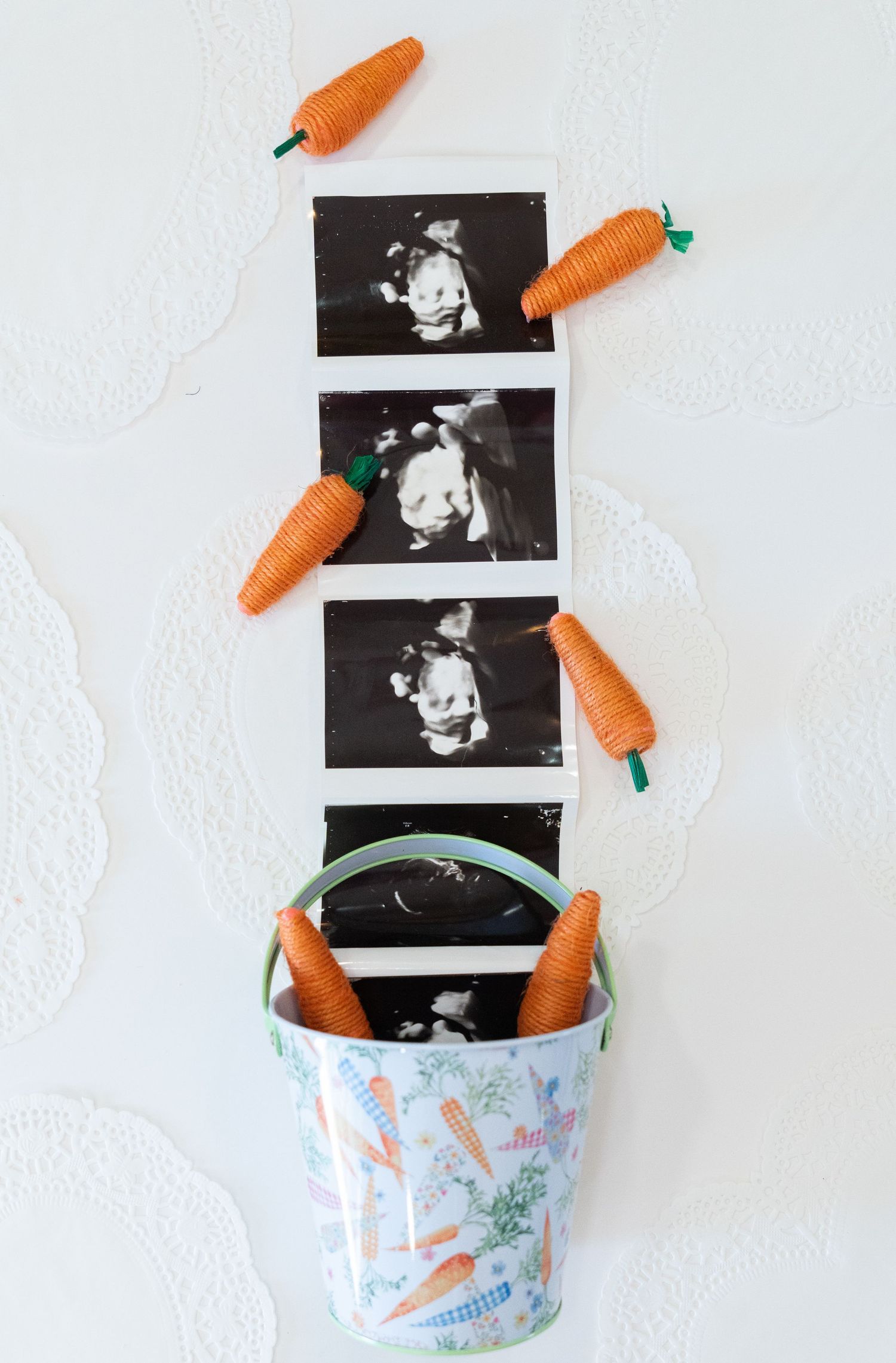 Baby ultrasound photo strip surrounded by toy carrots and Easter pail on white doily background.