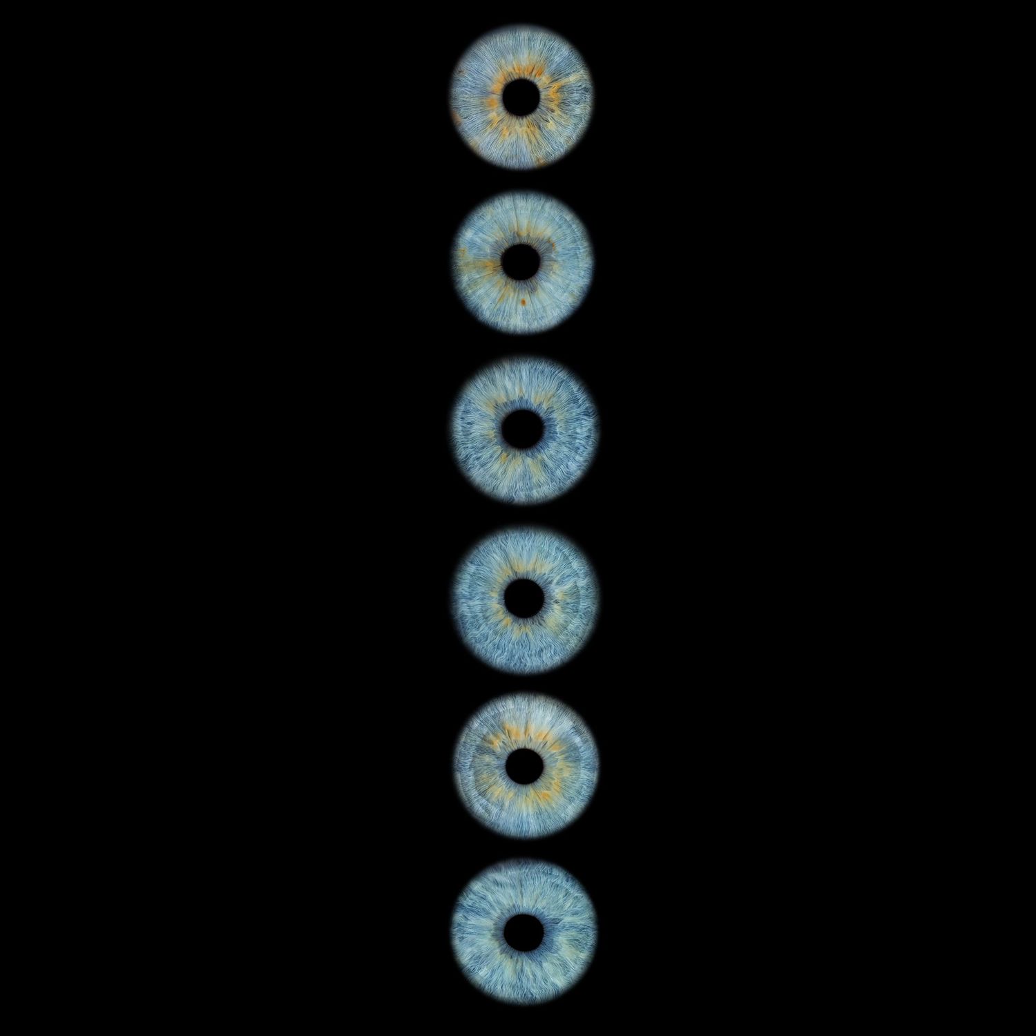 Six blue human irises arranged vertically in a column against a black background, showing detailed eye anatomy.