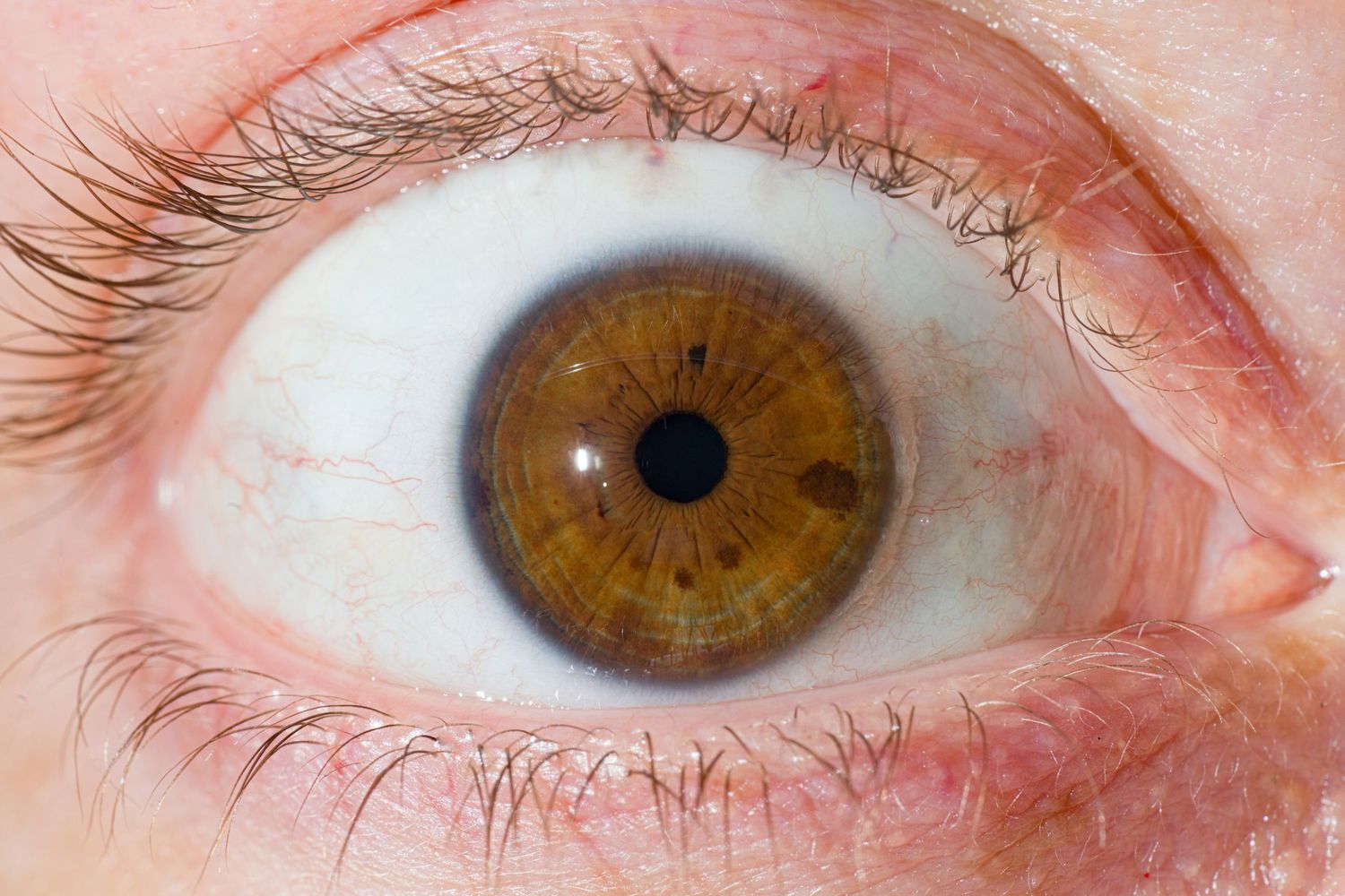 Close-up macro photo of a human eye with amber brown iris and visible red veins on white sclera.