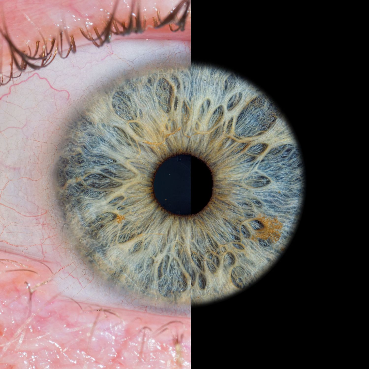 Split macro image of human eye showing green-gray iris detail alongside visible eyelid skin texture.