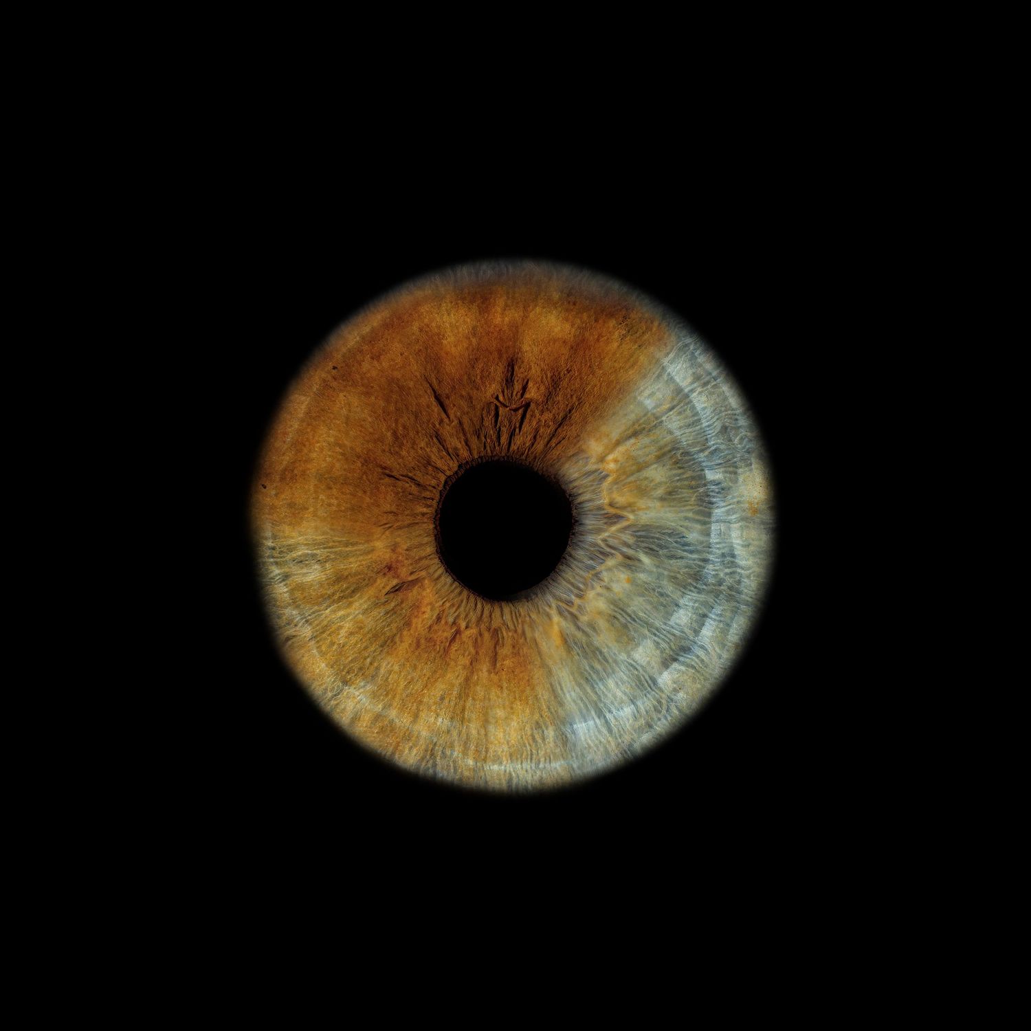 Close-up macro photograph of a human eye iris showing golden brown and blue tones with detailed texture on black background.