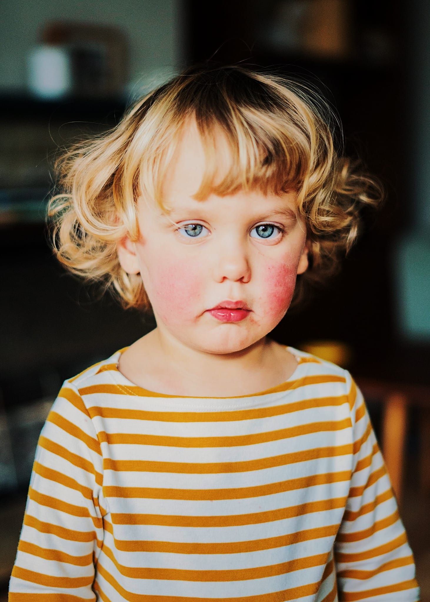 A blue-eyed blonde toddler in a yellow striped top with rosy cheeks looks at the camera.