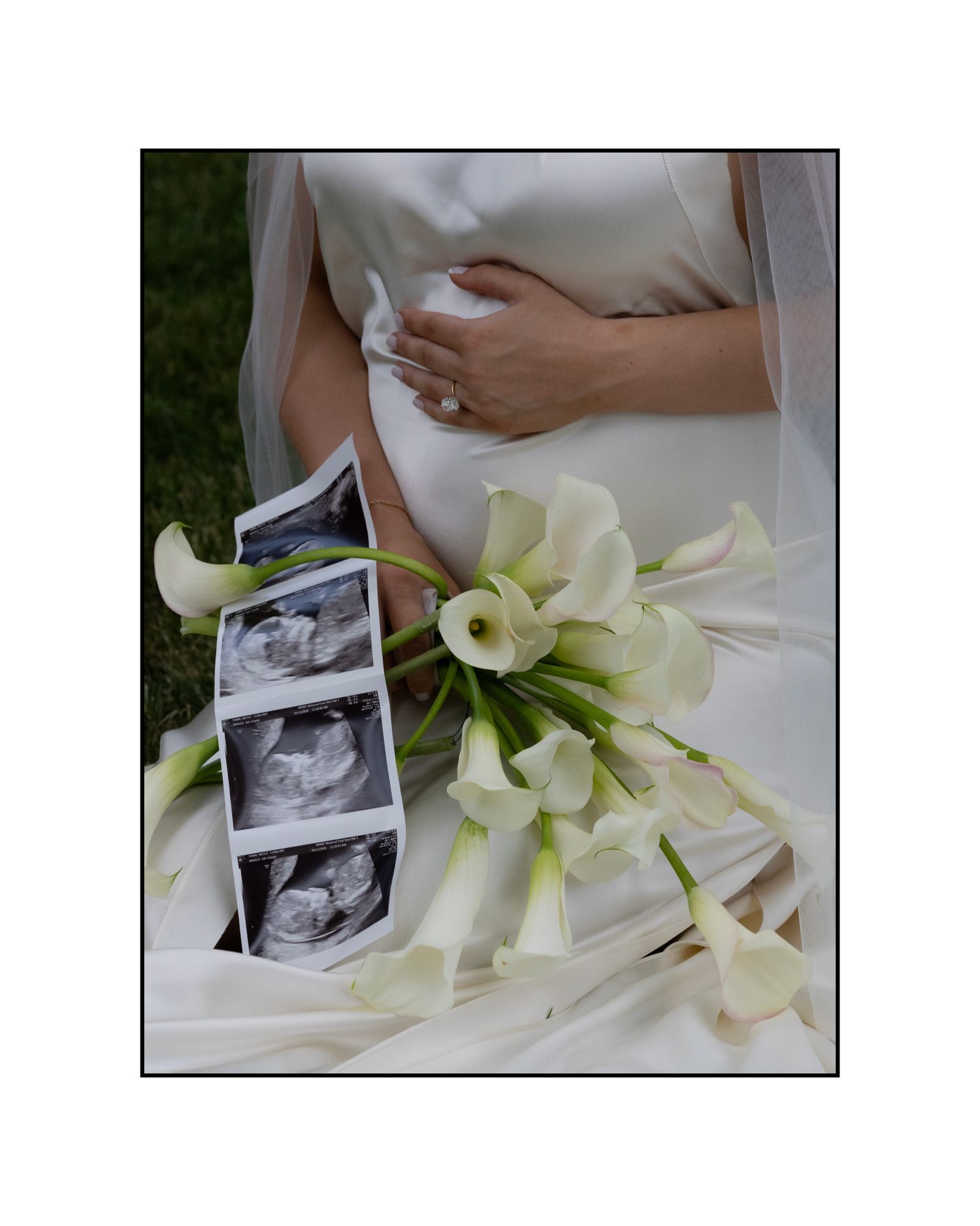Pregnant bride in white gown holding calla lily bouquet beside ultrasound photos on grass.