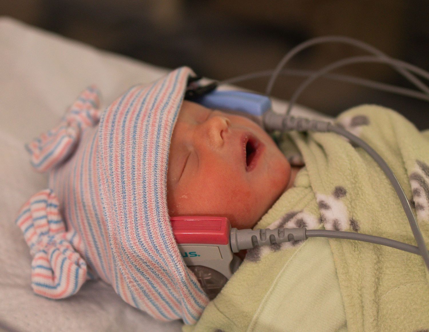 Newborn baby in striped hat with medical monitors in hospital NICU nursery care unit.