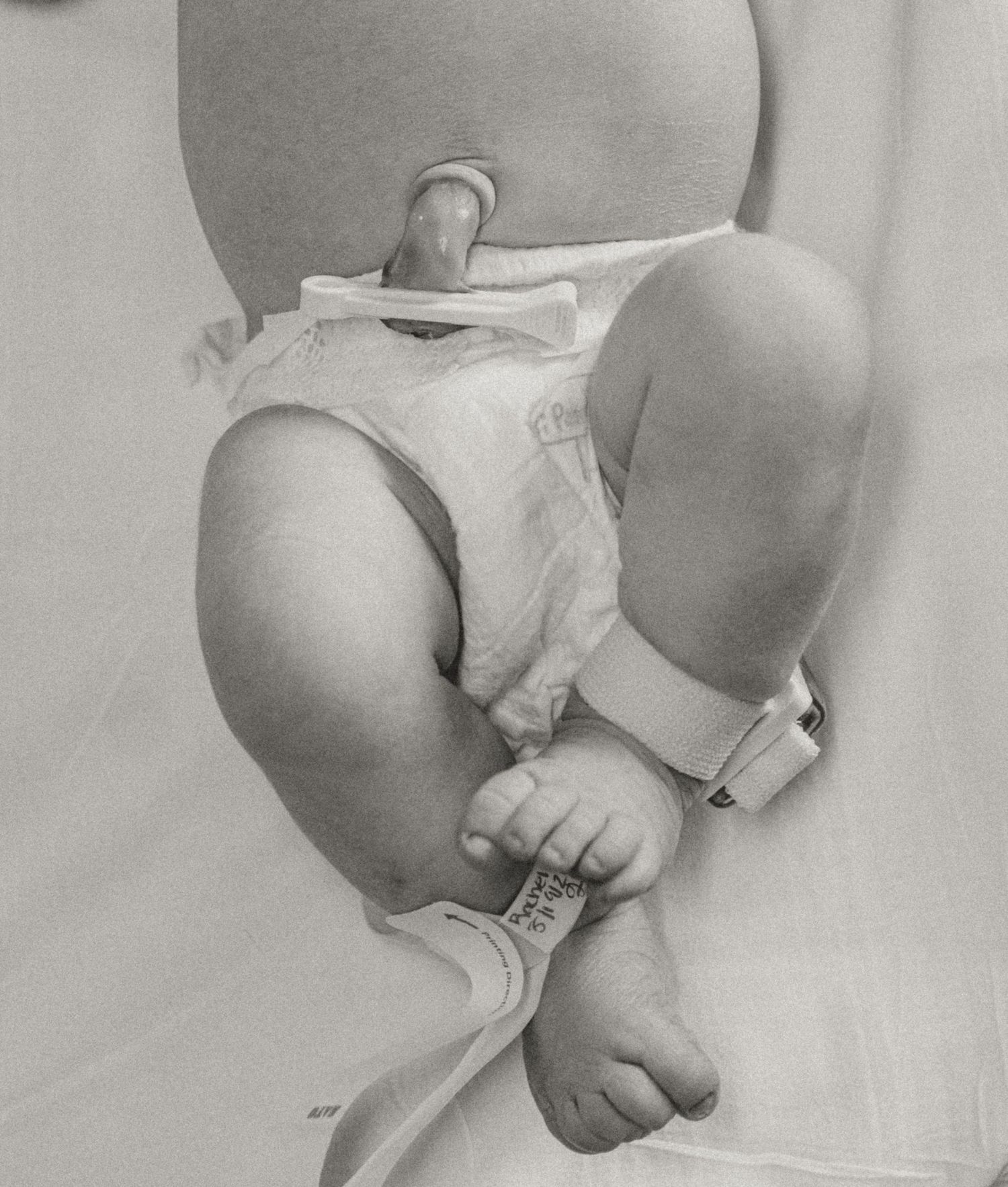 Black and white close-up of a newborn baby's legs and feet with a hospital ID bracelet in a diaper.