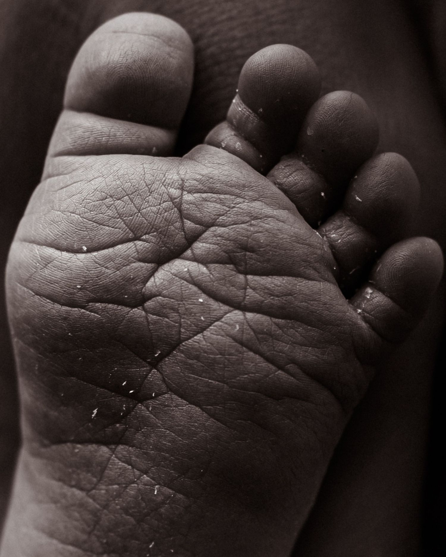 Macro-Newborn-Close-up-Details-Newborn-Feet-toes-flakey-skin