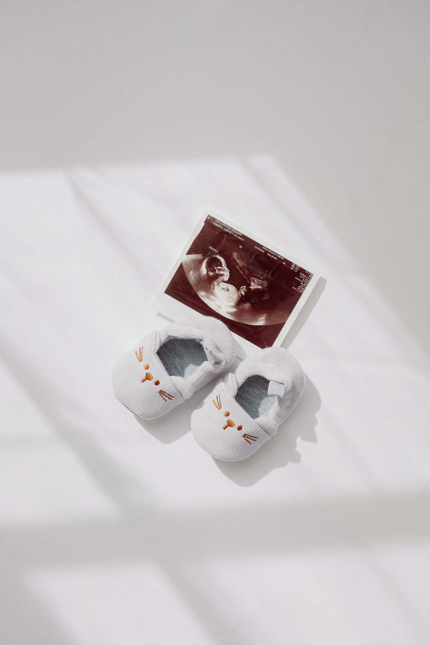 Baby shoes and ultrasound photo arranged on white surface with dramatic shadows.