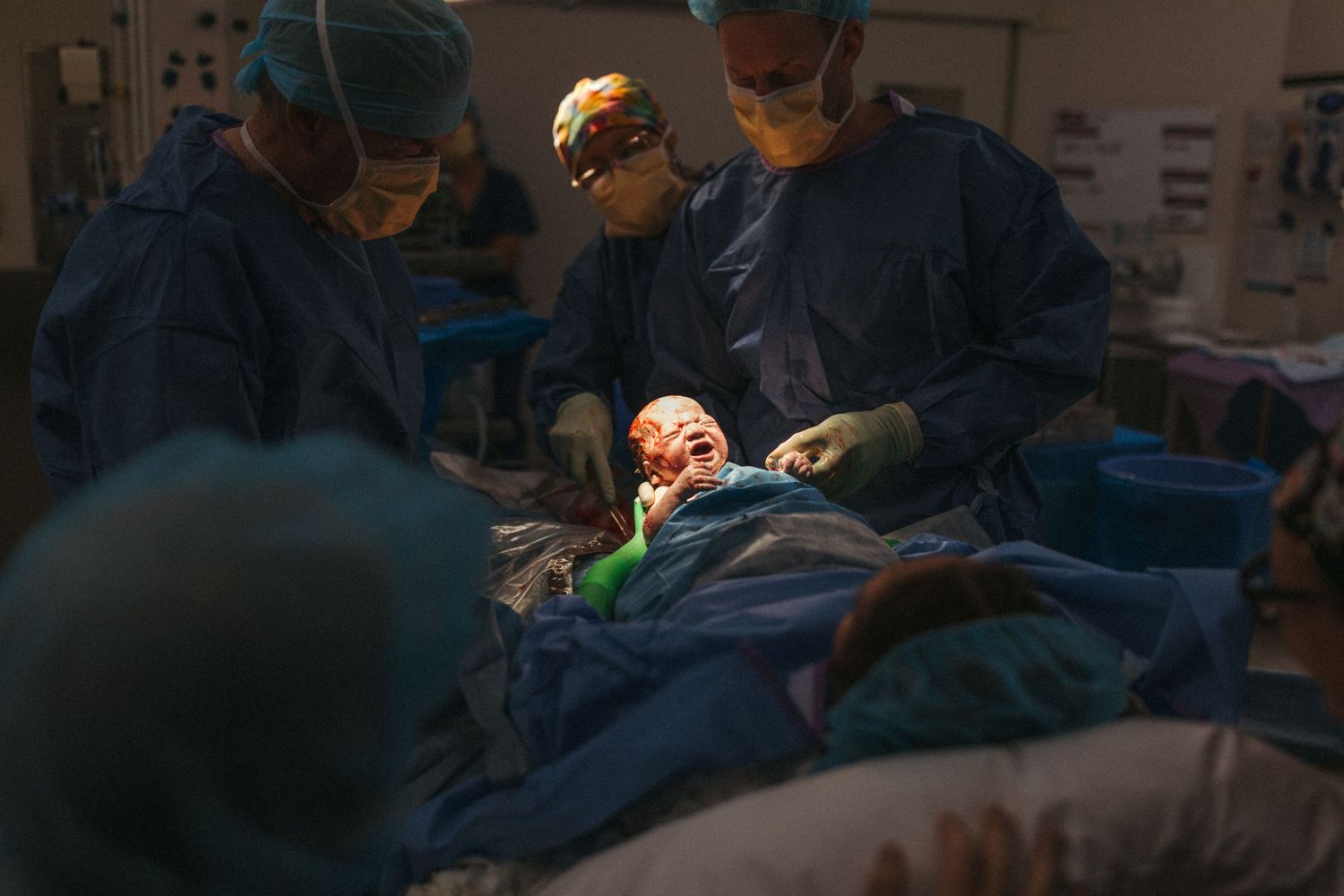 Medical team in surgical scrubs and masks performing an operation in a dimly lit operating room.