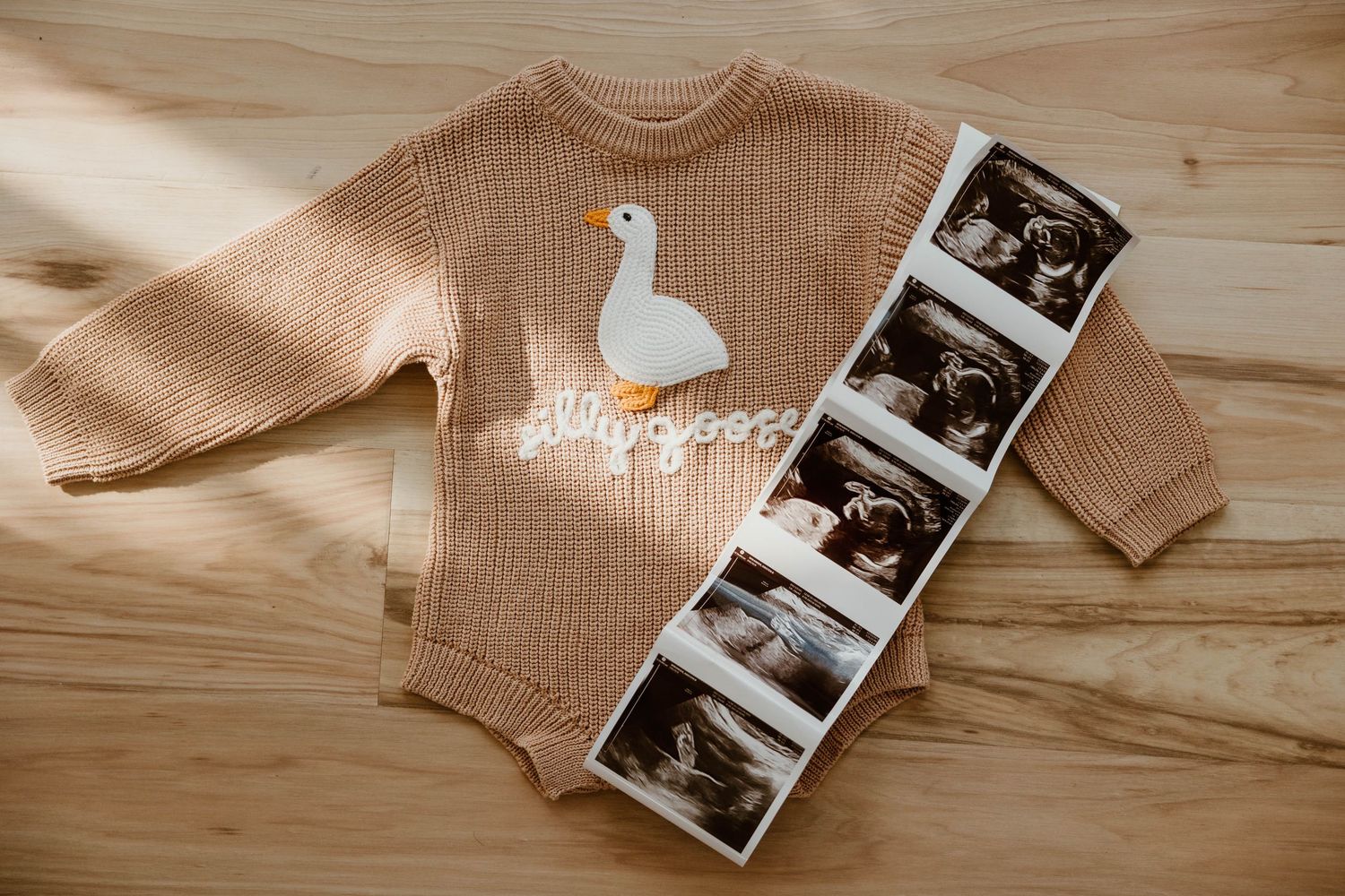 Ultrasound photos arranged with beige knit fabric on wooden surface.