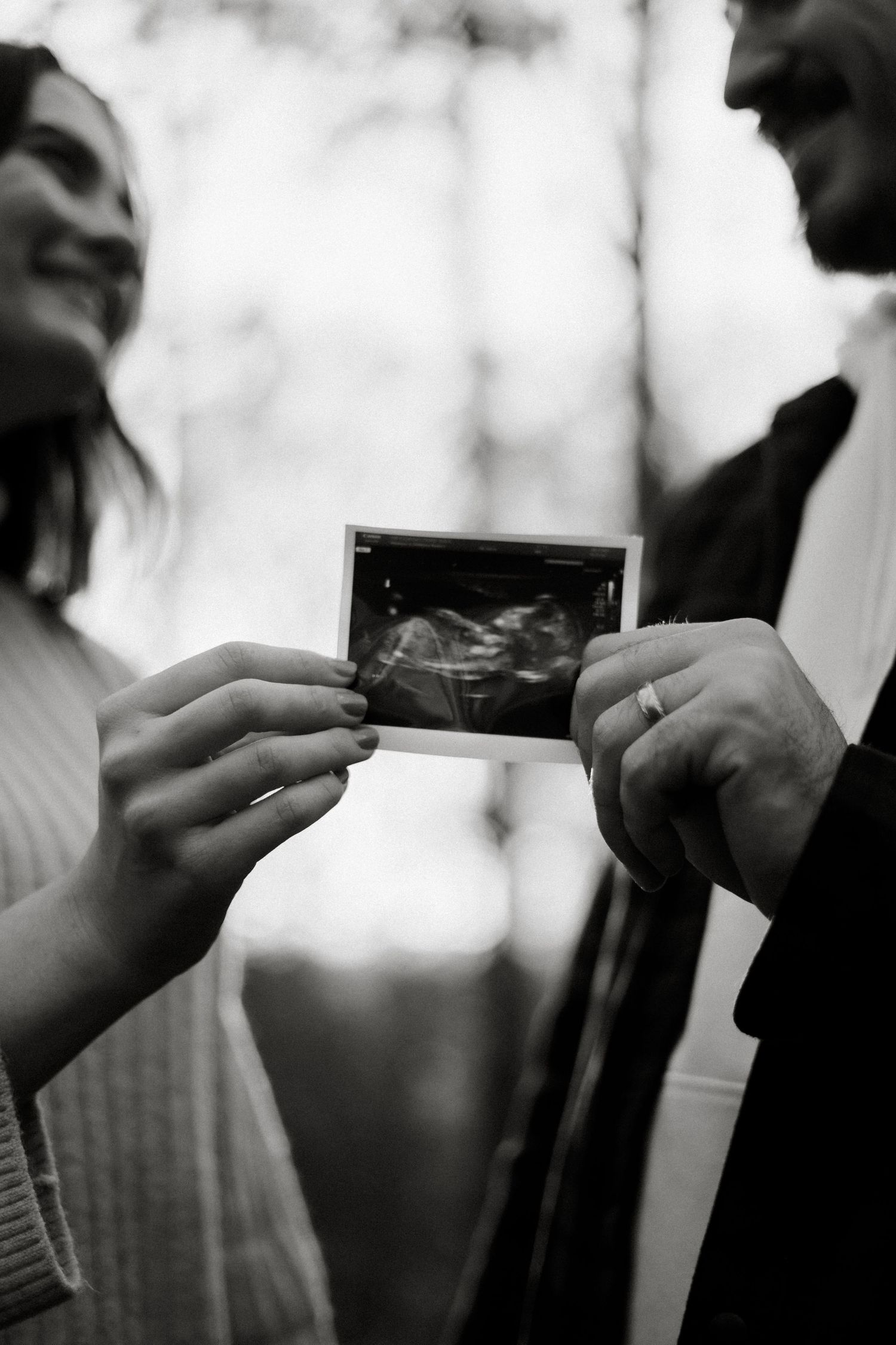 Black and white photo of couple holding ultrasound scan together in forest, pregnancy reveal.