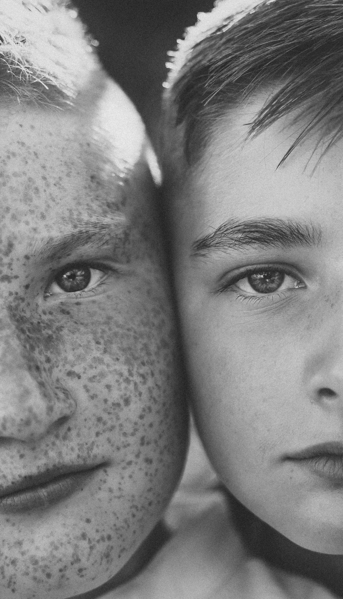 Black and white close-up portrait of two young boys with different skin textures, one with freckles, cheeks touching.