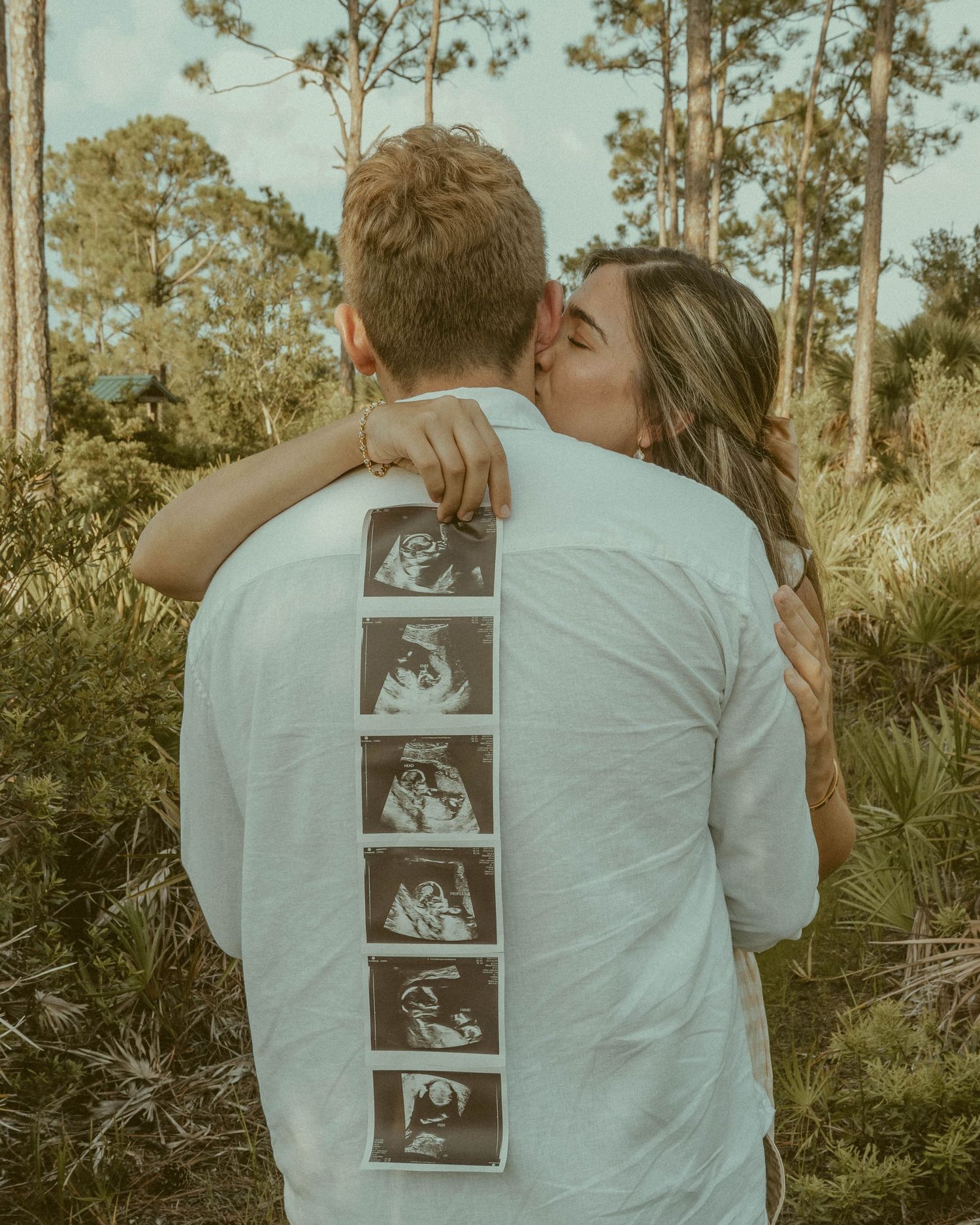 couple poses with sonogram held over man's left shoulder in Myakka state park.