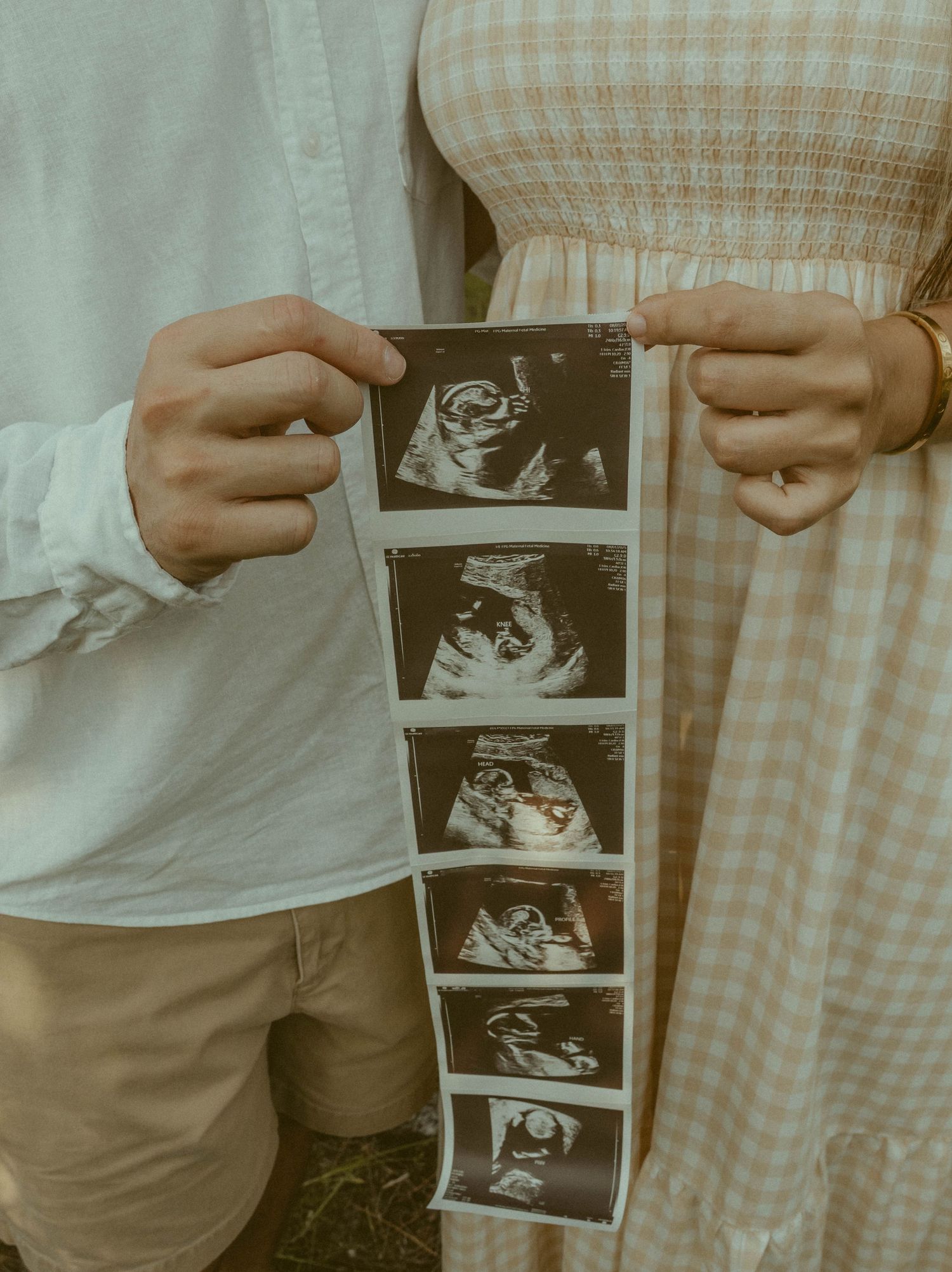 couple holds their sonogram of new baby at Myakka state park, Florida
