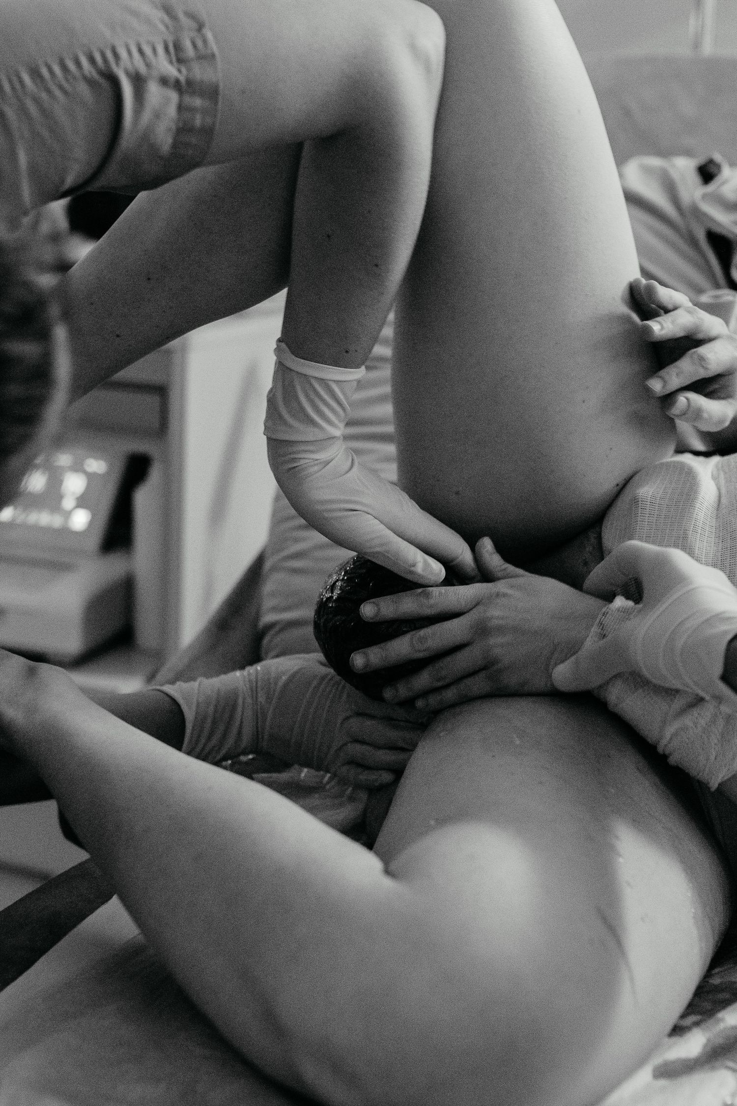 Black-and-white image of a baby’s birth in Newport Beach.