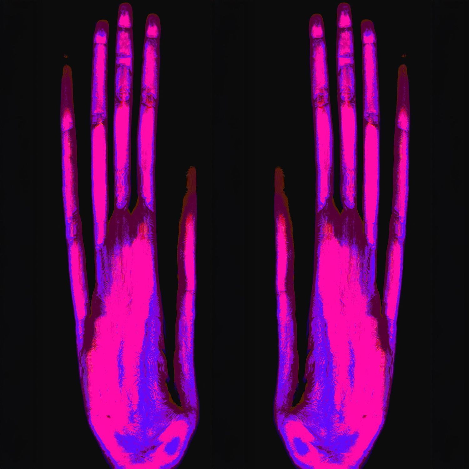 Fluorescent X-ray image of two human hands glowing in pink and purple under ultraviolet light on black background.