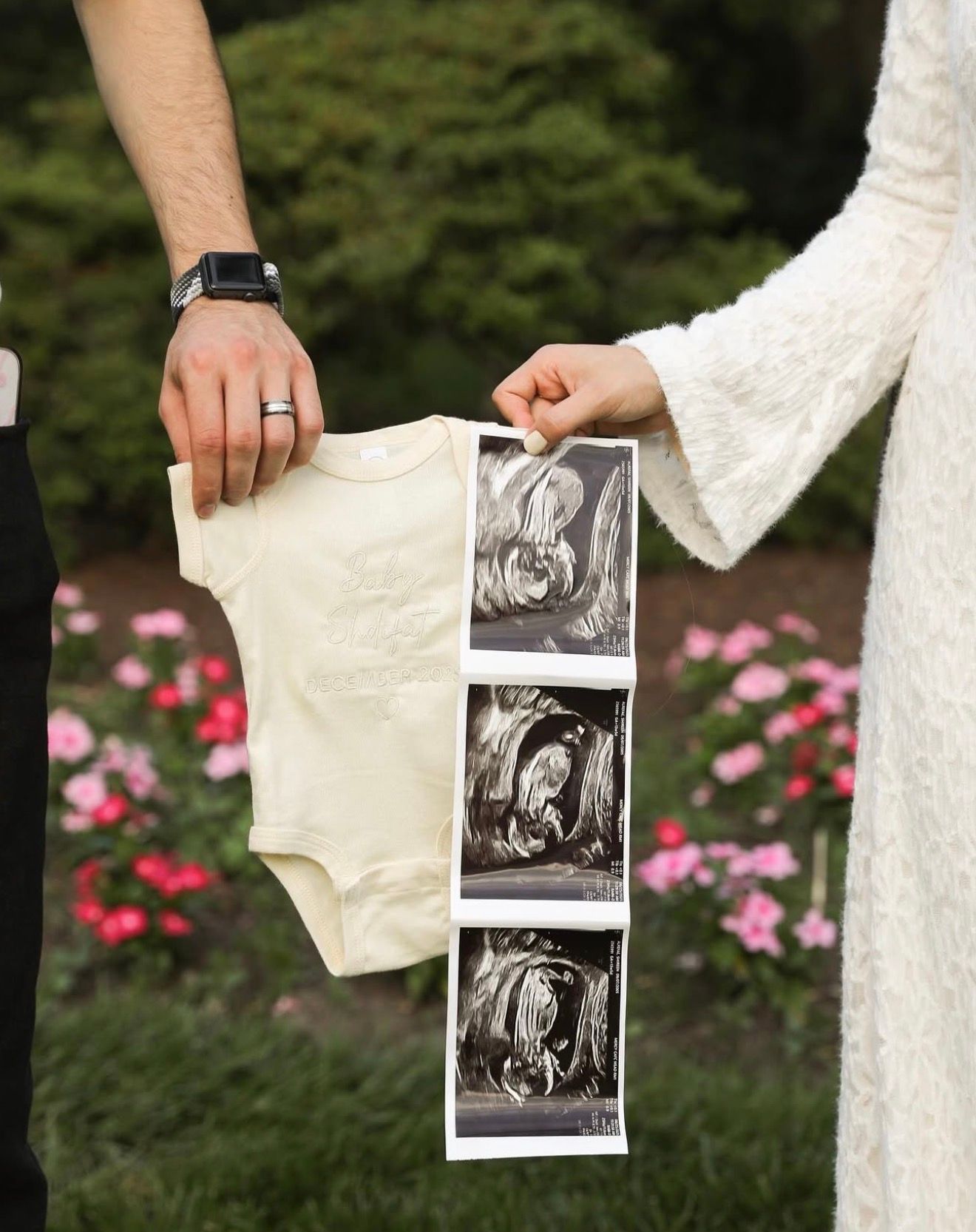 A series of black and white ultrasound photos being held up against a white dress with pink flowers in the background.