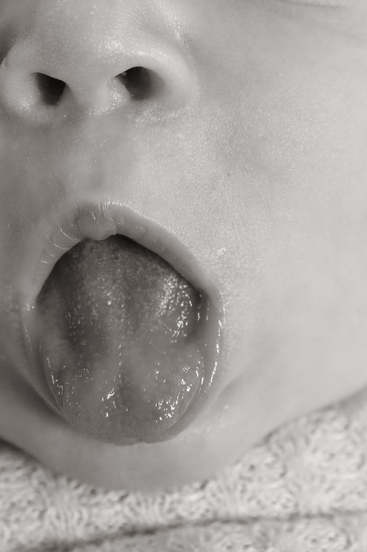 A close-up black and white photo shows a small open mouth with nose above, showing texture and detail.
