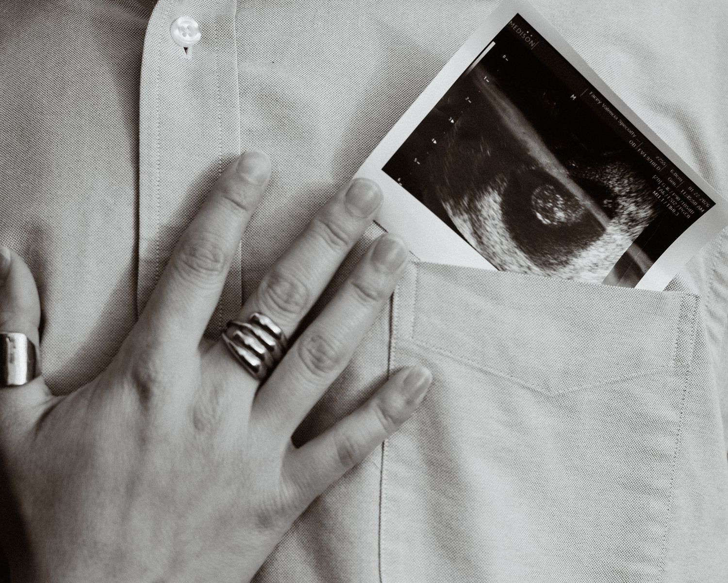 Black and white close-up of man's hand with rings and ultrasound photo in shirt pocket.