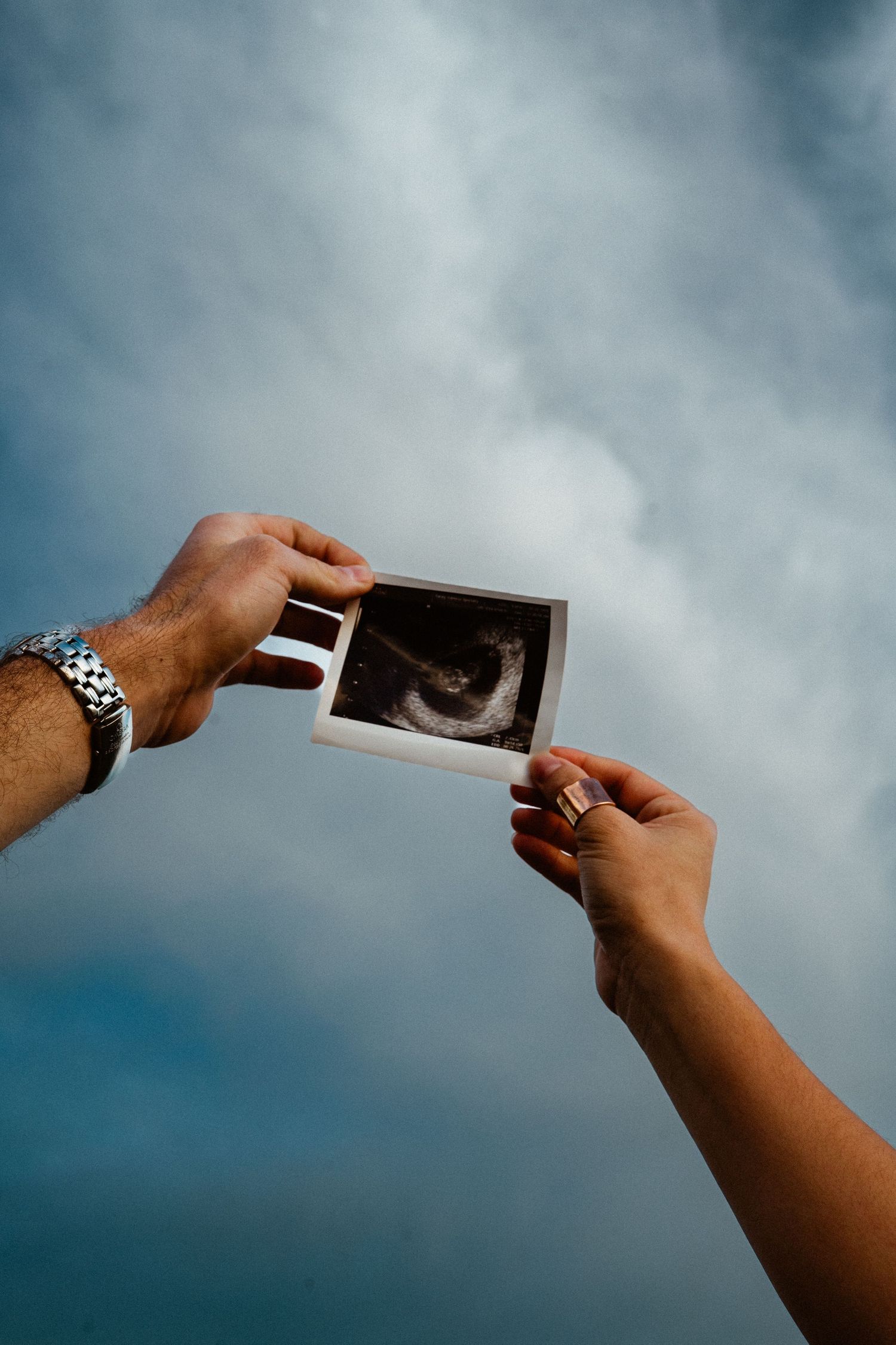 Couple holding ultrasound photo up against blue cloudy sky outdoors.