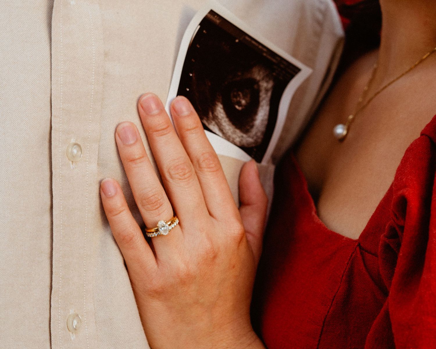 Close-up of woman's hand with engagement ring resting near ultrasound photo tucked in shirt pocket.