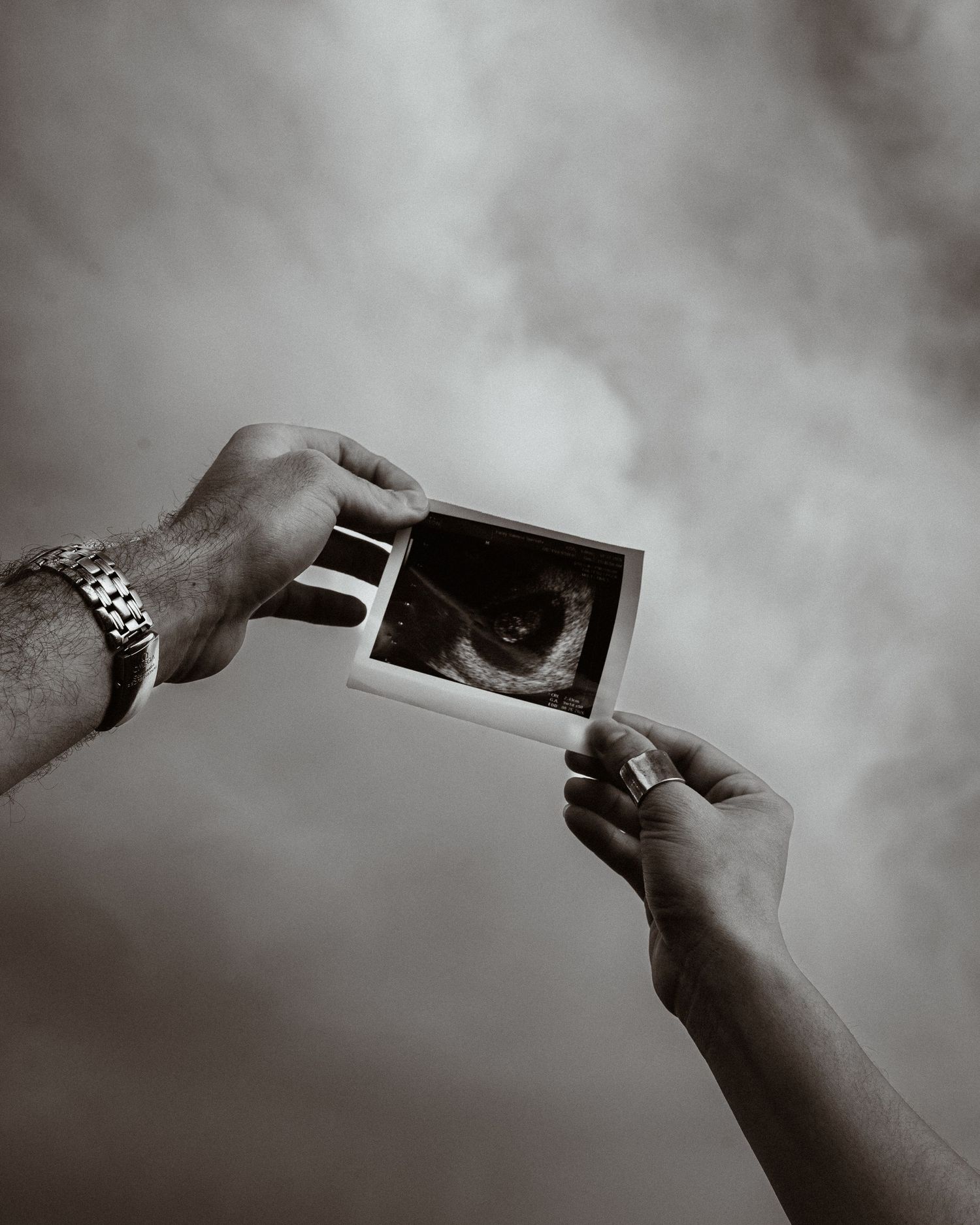 Two hands holding ultrasound photo against cloudy sky, black and white.