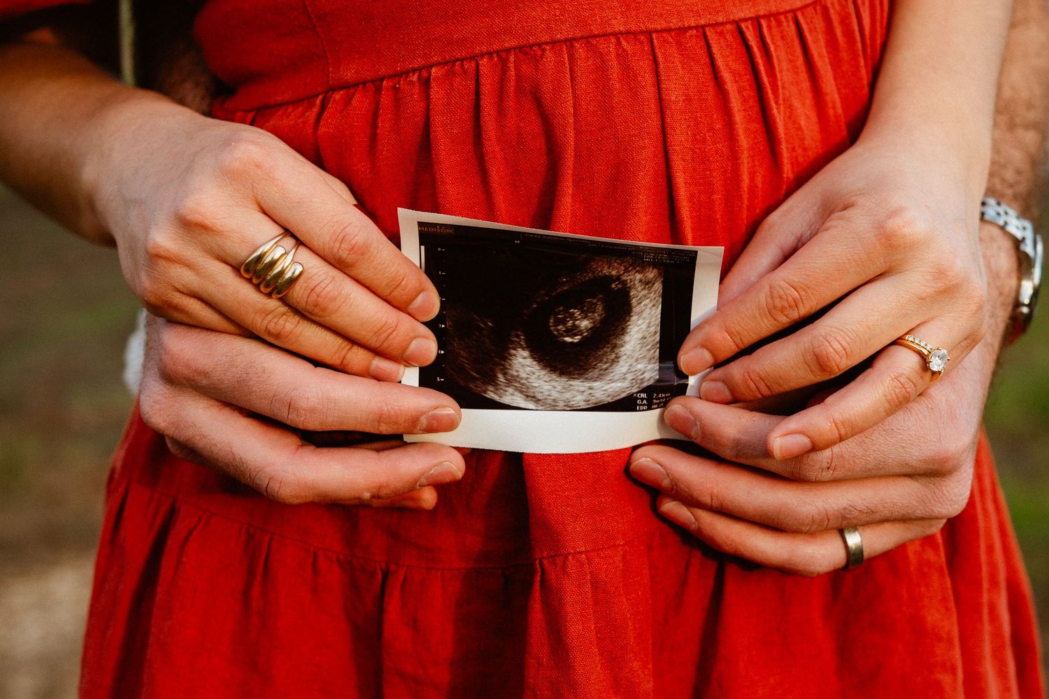 Close-up of couple's hands holding ultrasound photo, woman wearing gold rings and red dress.