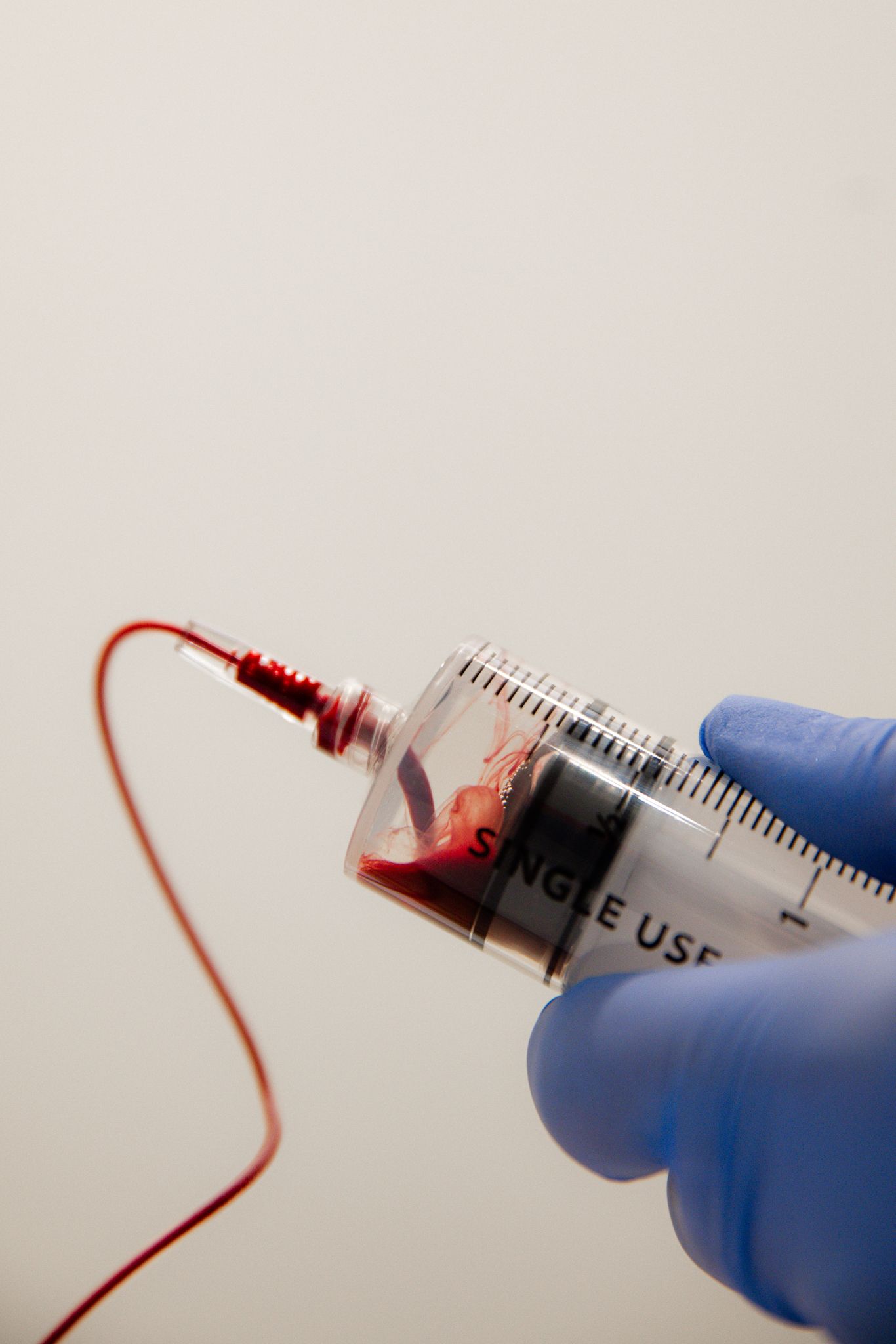 Gloved hand holds a single-use syringe filled with red blood connected to a thin red tube on light background.