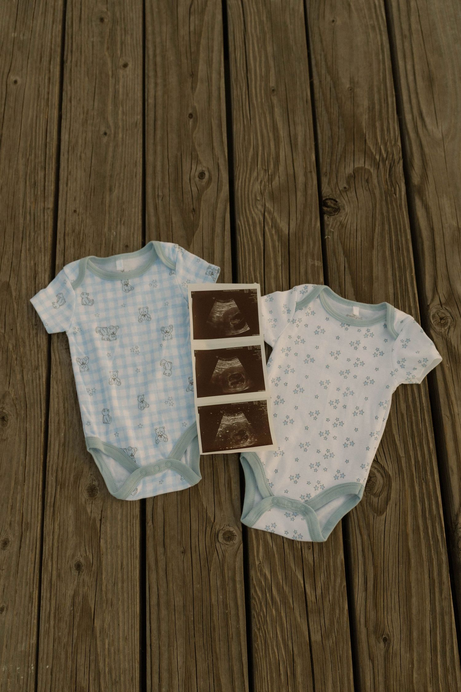 Baby onesies and ultrasound photos laid out on wooden deck in progression showing pregnancy announcement.