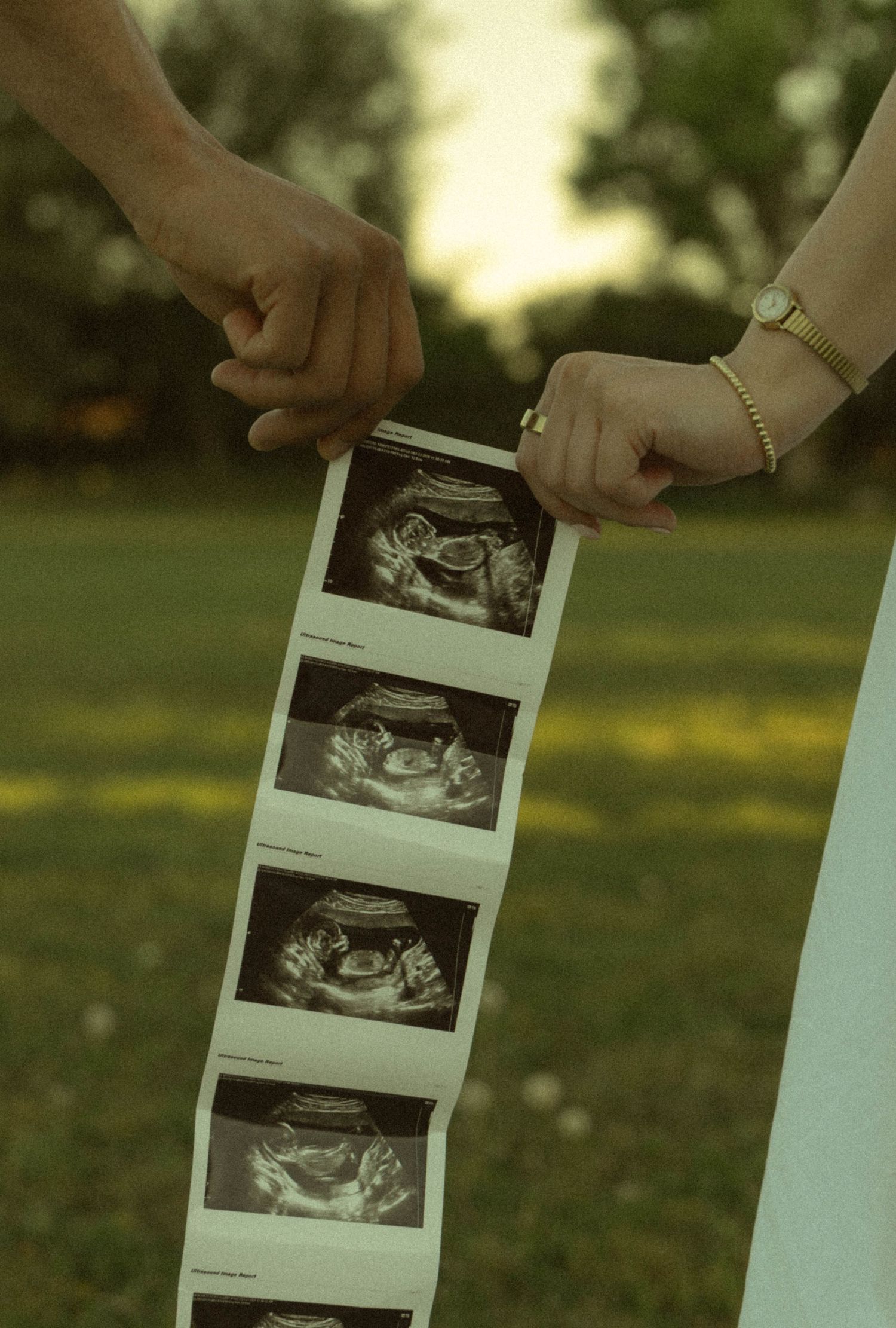 Couple holding hands and ultrasound sonogram photos outdoors, pregnancy announcement in green park setting.