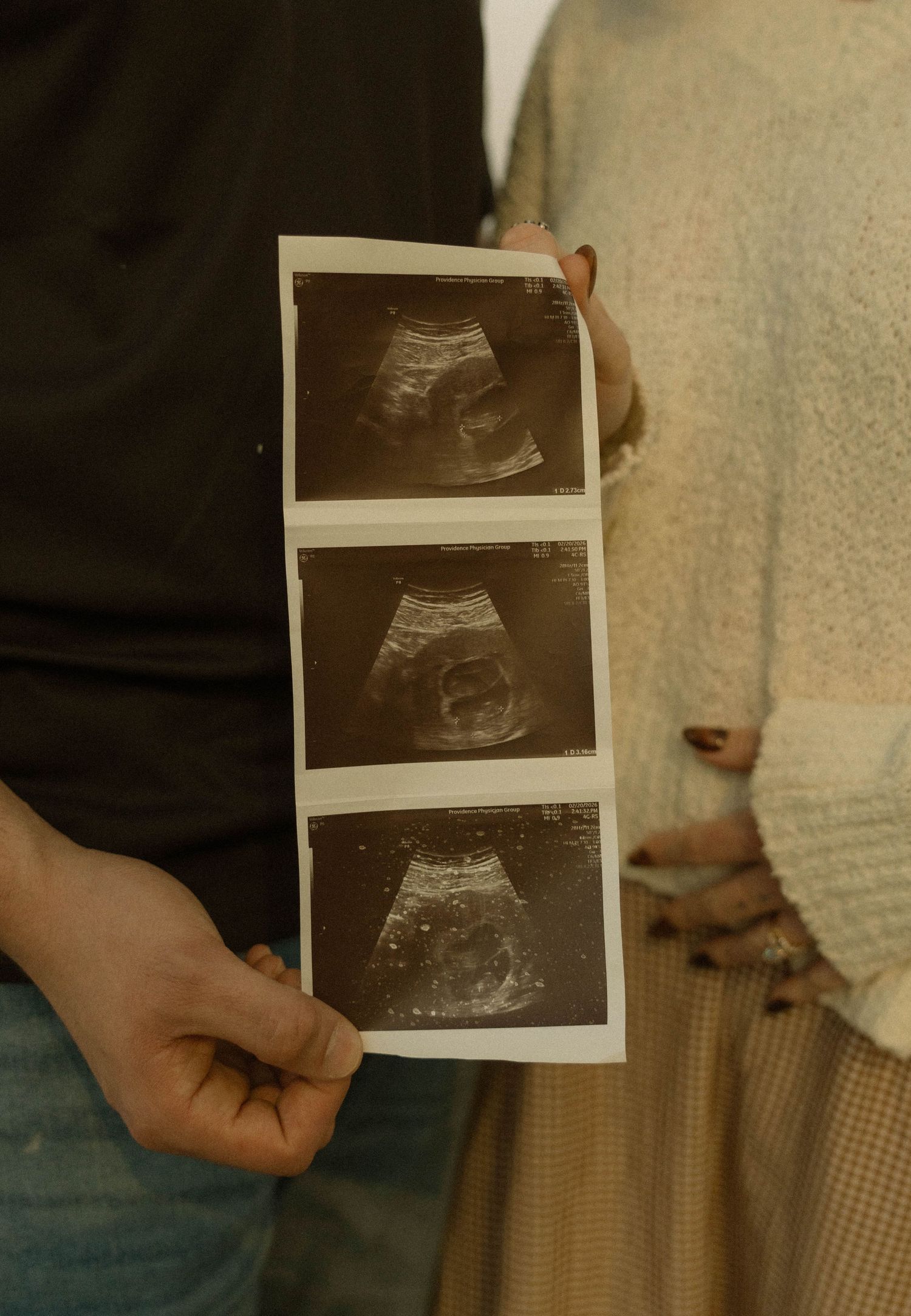 Ultrasound sonogram photos being held up showing pregnancy scan images.