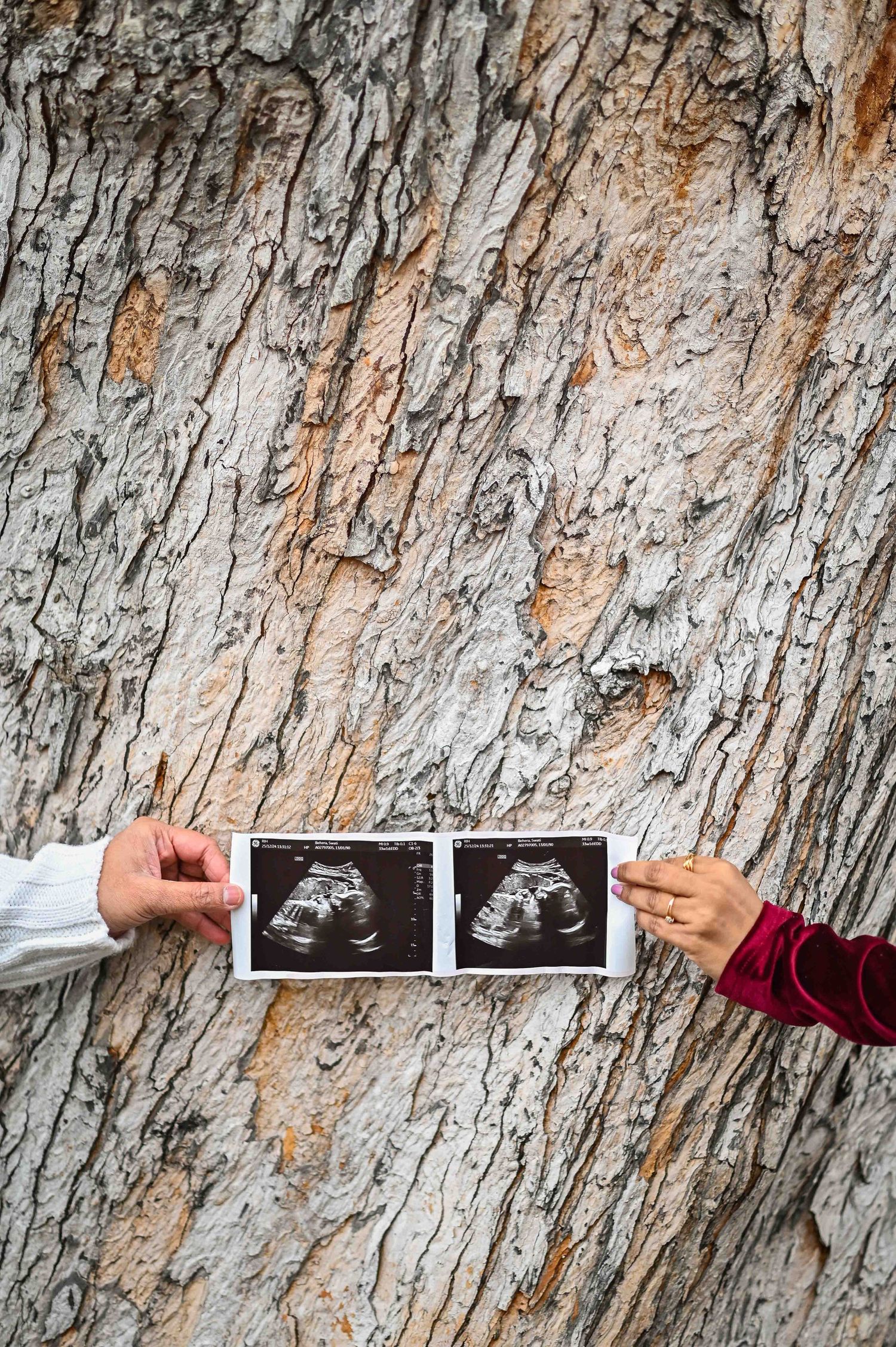 Couple holding ultrasound photos against a textured tree bark background, announcing their pregnancy.
