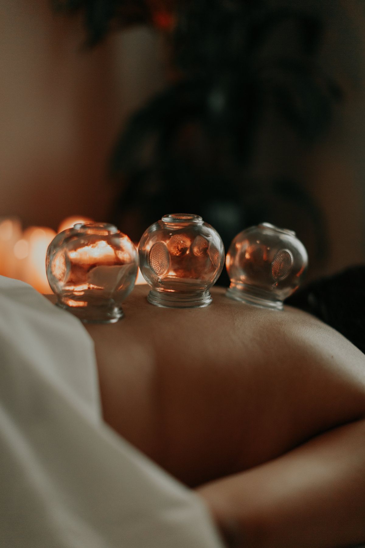 Three glass cupping therapy cups placed on a person's back during a traditional Chinese medicine treatment session.