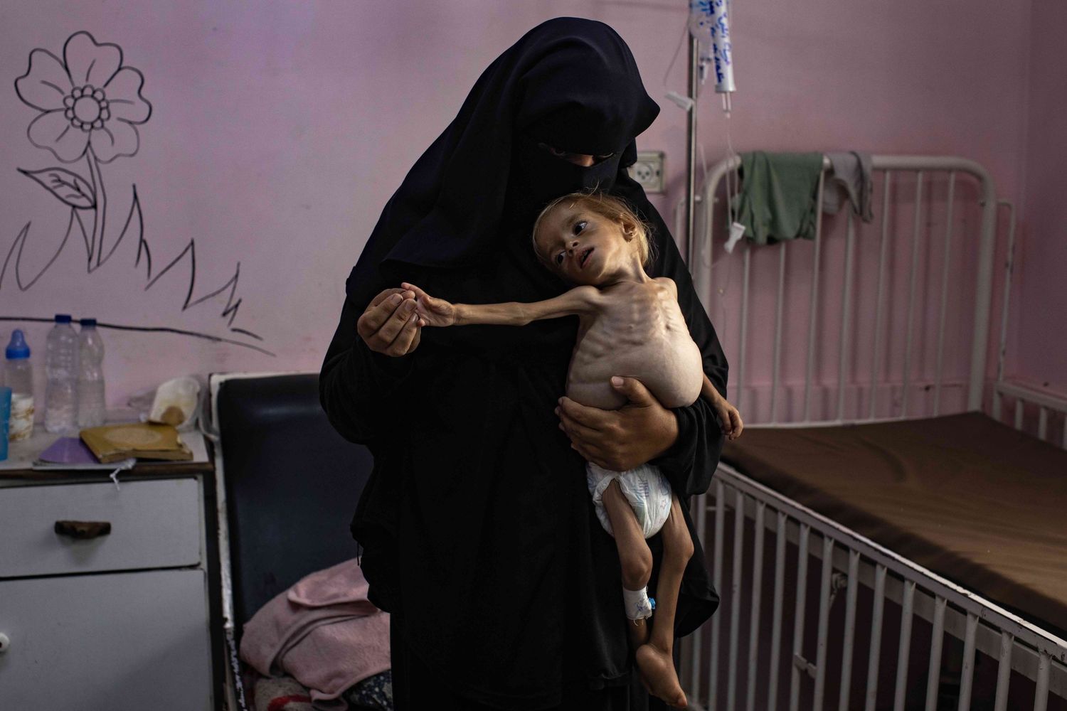 Sham Qudeih, a malnourished 2-year-old, held by her mother at Nasser Hospital, Khan Younis, Gaza, Aug. 2025