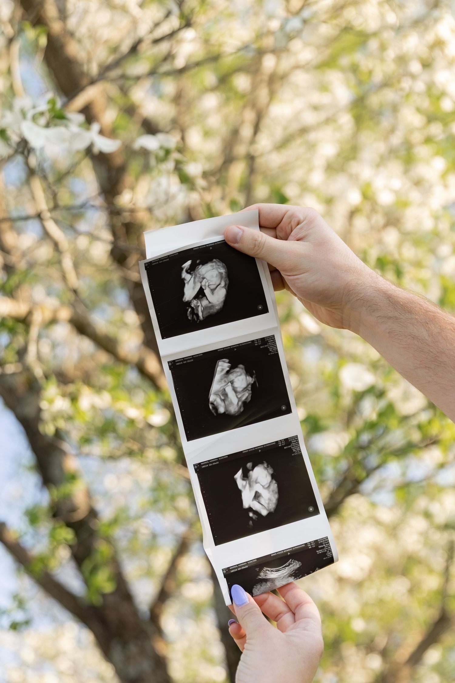 Hands hold a strip of three ultrasound photos in front of a blossoming tree outdoors.