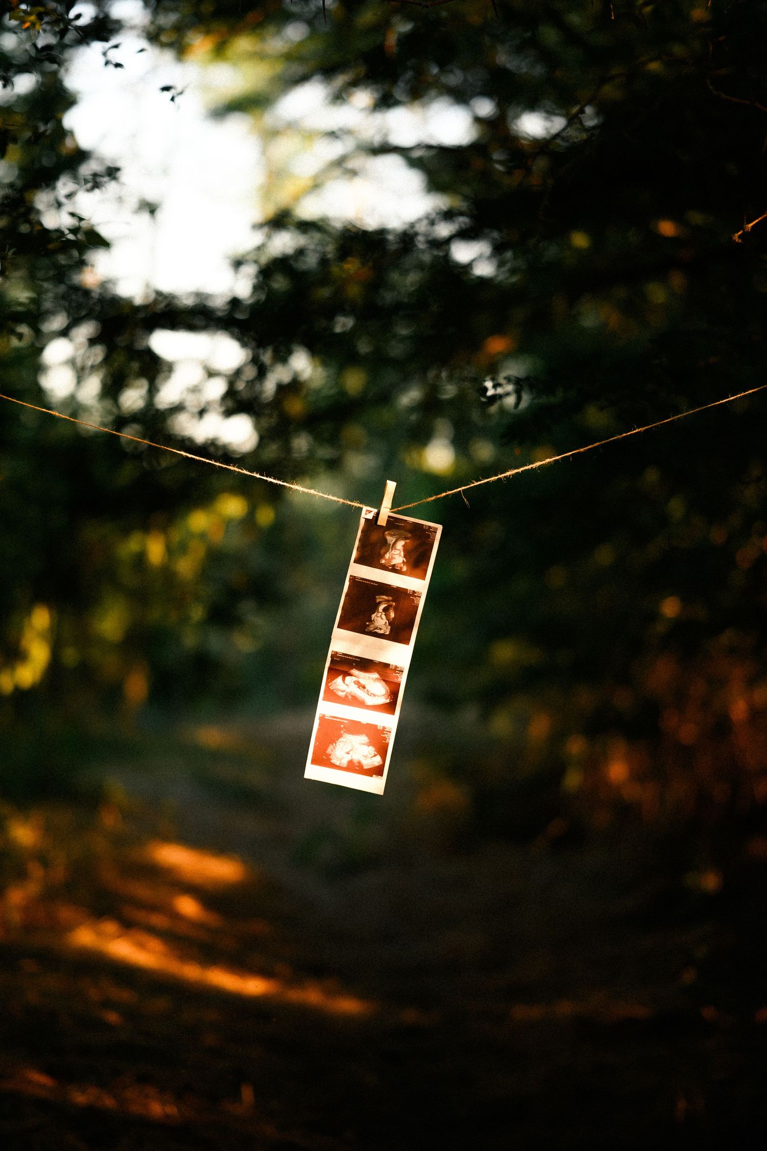 Ultrasound photos hanging on a string with a clothespin in a sunlit forest path.
