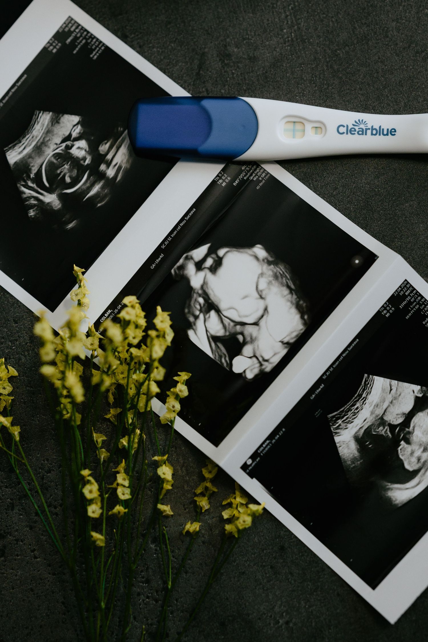 Clearblue pregnancy test beside ultrasound scan photos and yellow flowers arranged on dark surface.