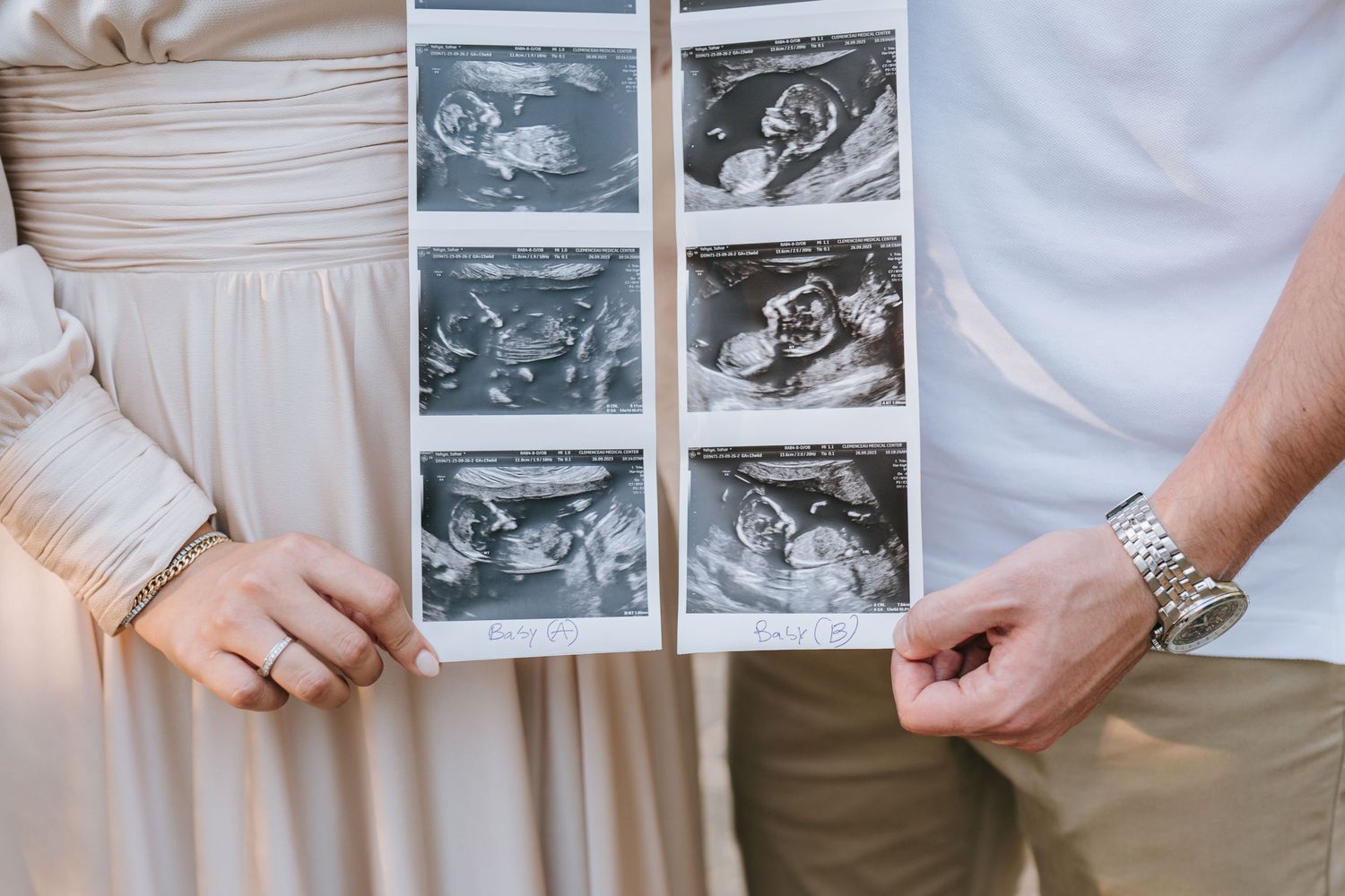 A close-up view of ultrasound scan photos being held against a light-colored fabric background.