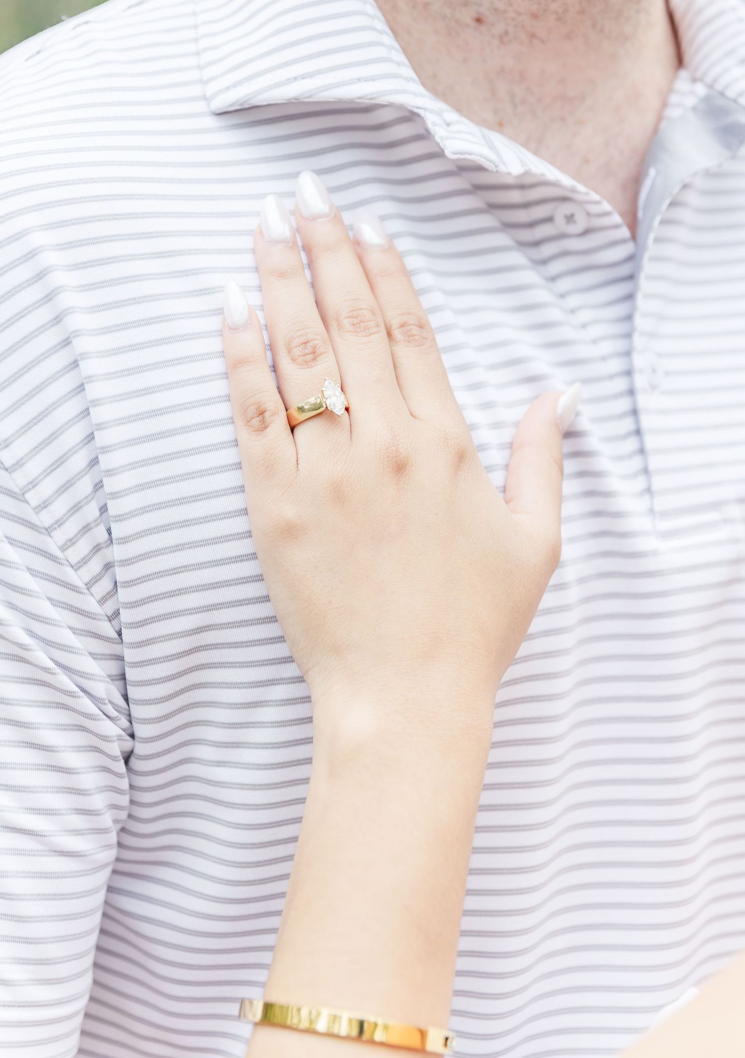 Close-up detail of hand with engagement ring against striped shirt.