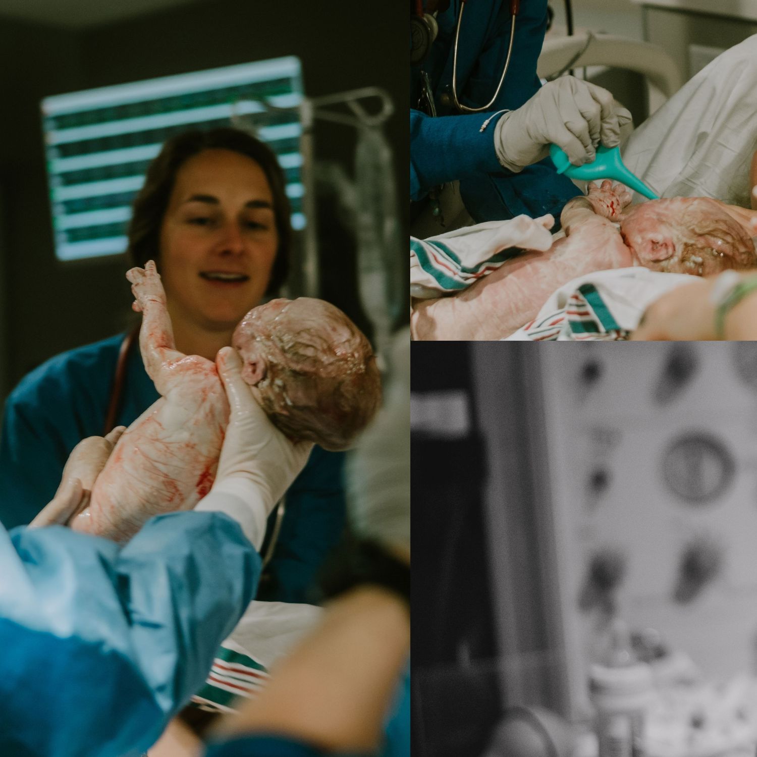 Medical team in scrubs delivering a newborn baby in an operating room during a cesarean section birth.