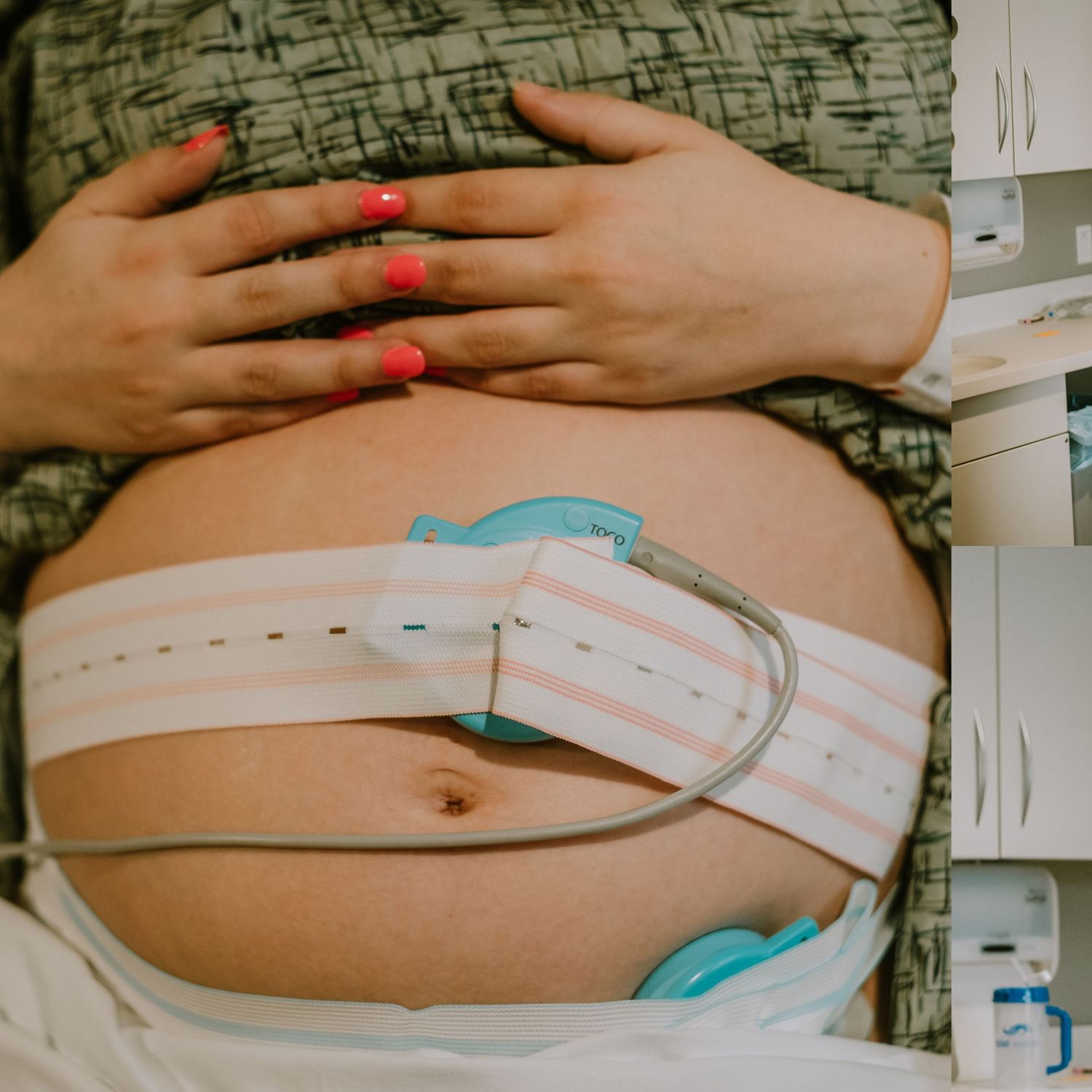 Pregnant woman lying down with fetal heart rate monitor straps on her belly during a prenatal checkup.