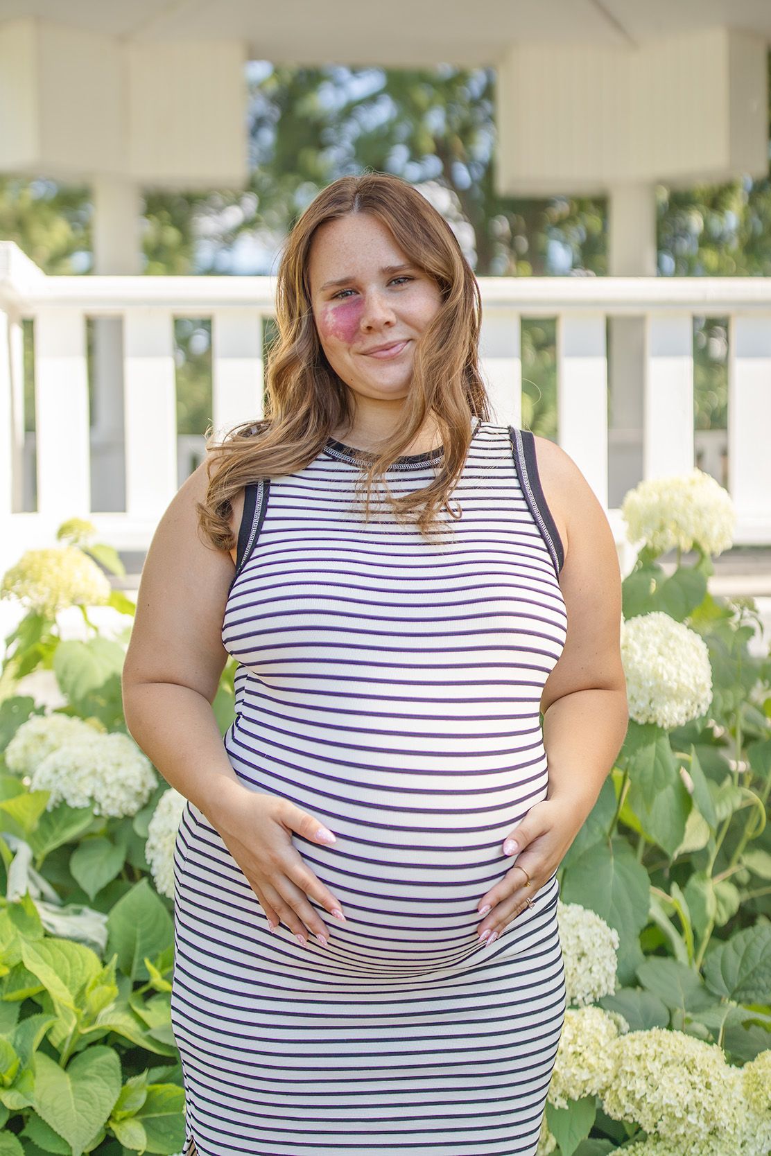 Pregnant woman in striped sleeveless dress cradling baby bump, standing near white hydrangeas in garden.