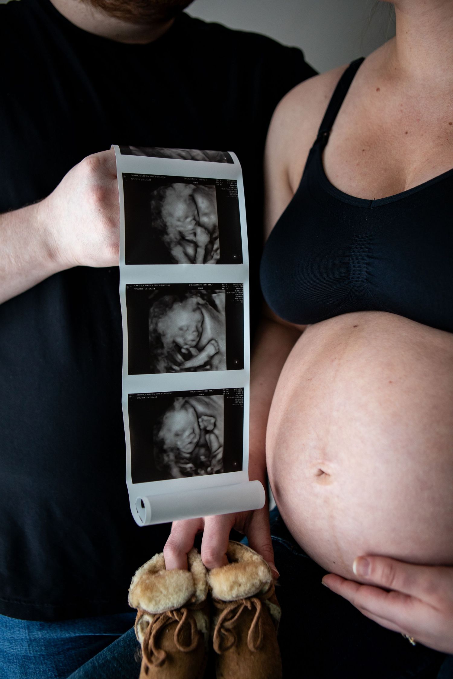 Pregnancy progression photos with ultrasound images and growing belly.