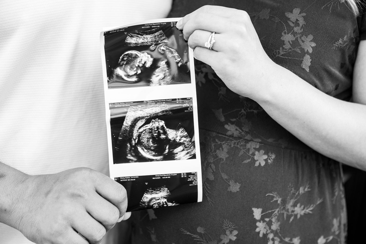 Black and white ultrasound images being held showing a developing baby.