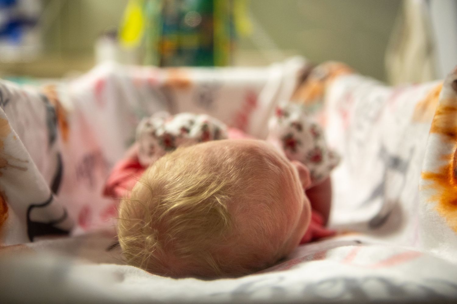 Baby resting in hospital bassinet with medical equipment visible.