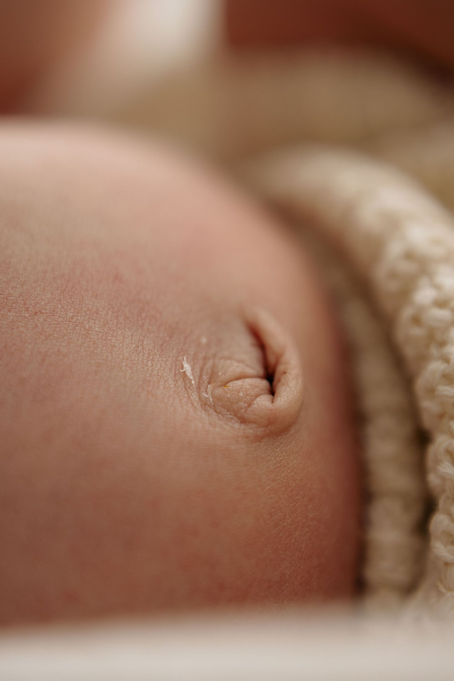 Macro shot of a newborn baby's healing umbilical cord stump on delicate skin.