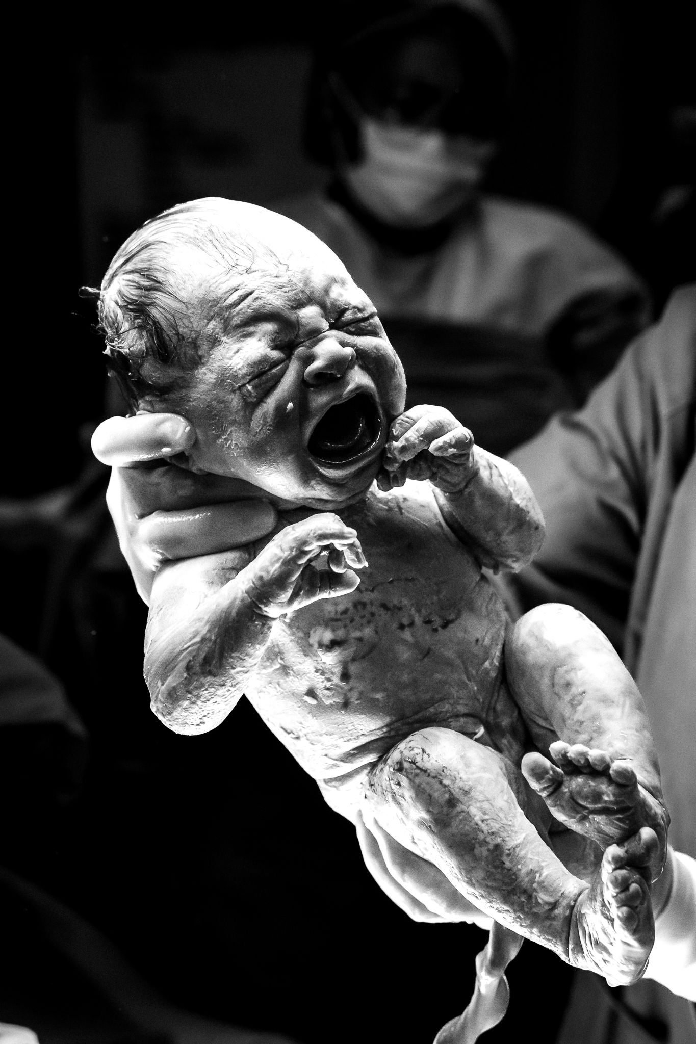 Black and white photograph of newborn baby crying during first moments after birth.