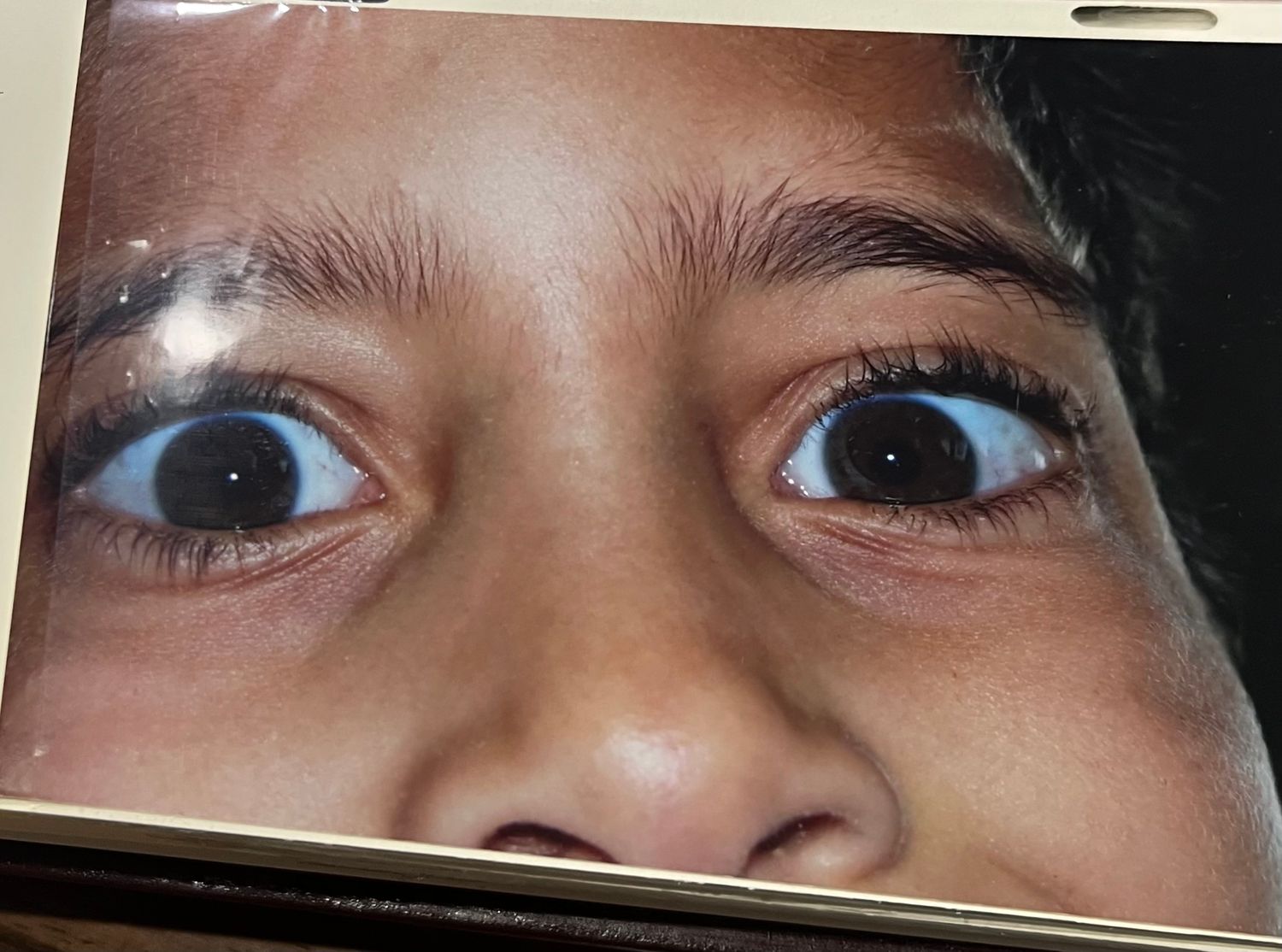 Close-up photo of child.